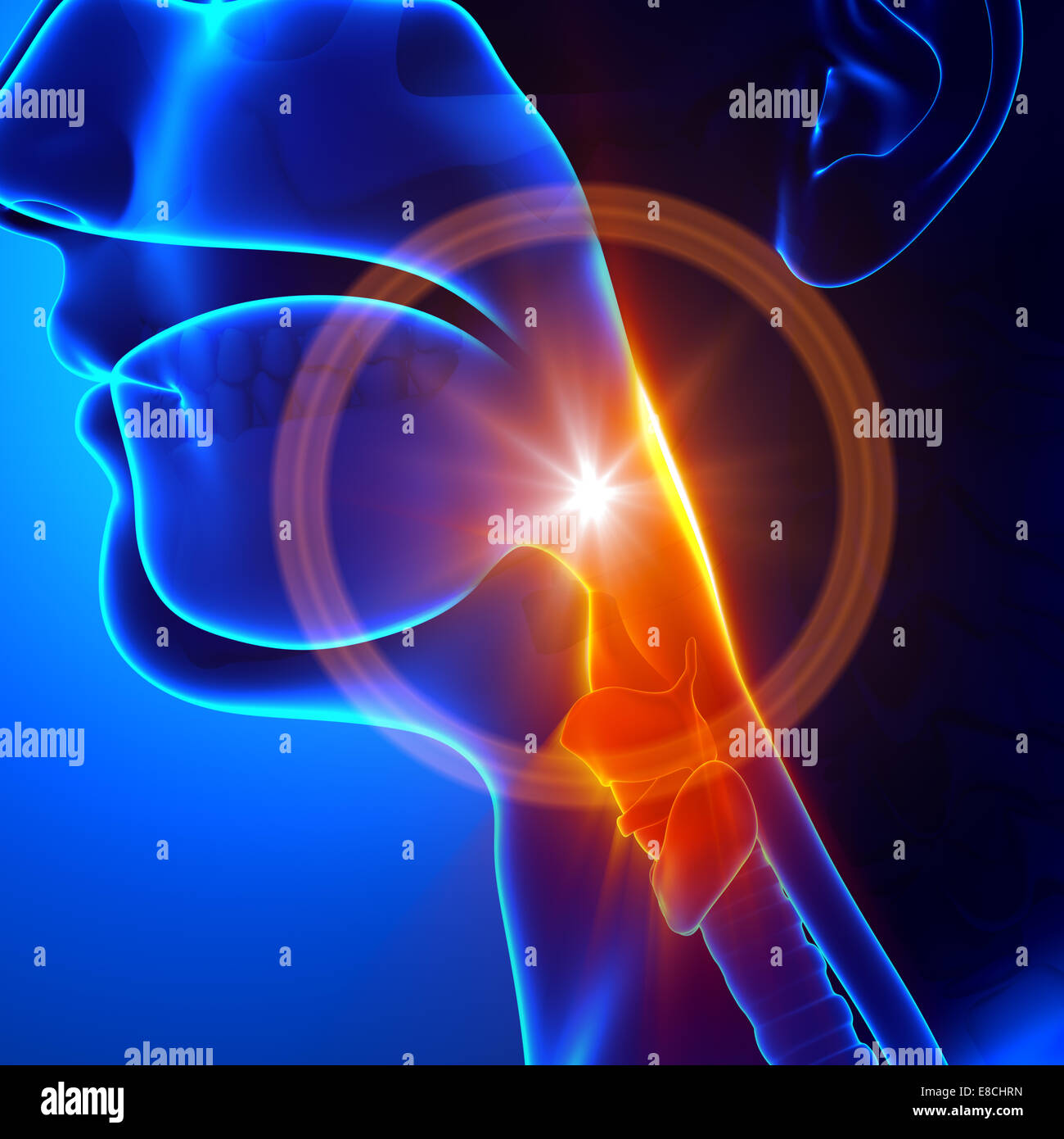 Sore throat Flu / Cold / Stuck throat Stock Photo Alamy