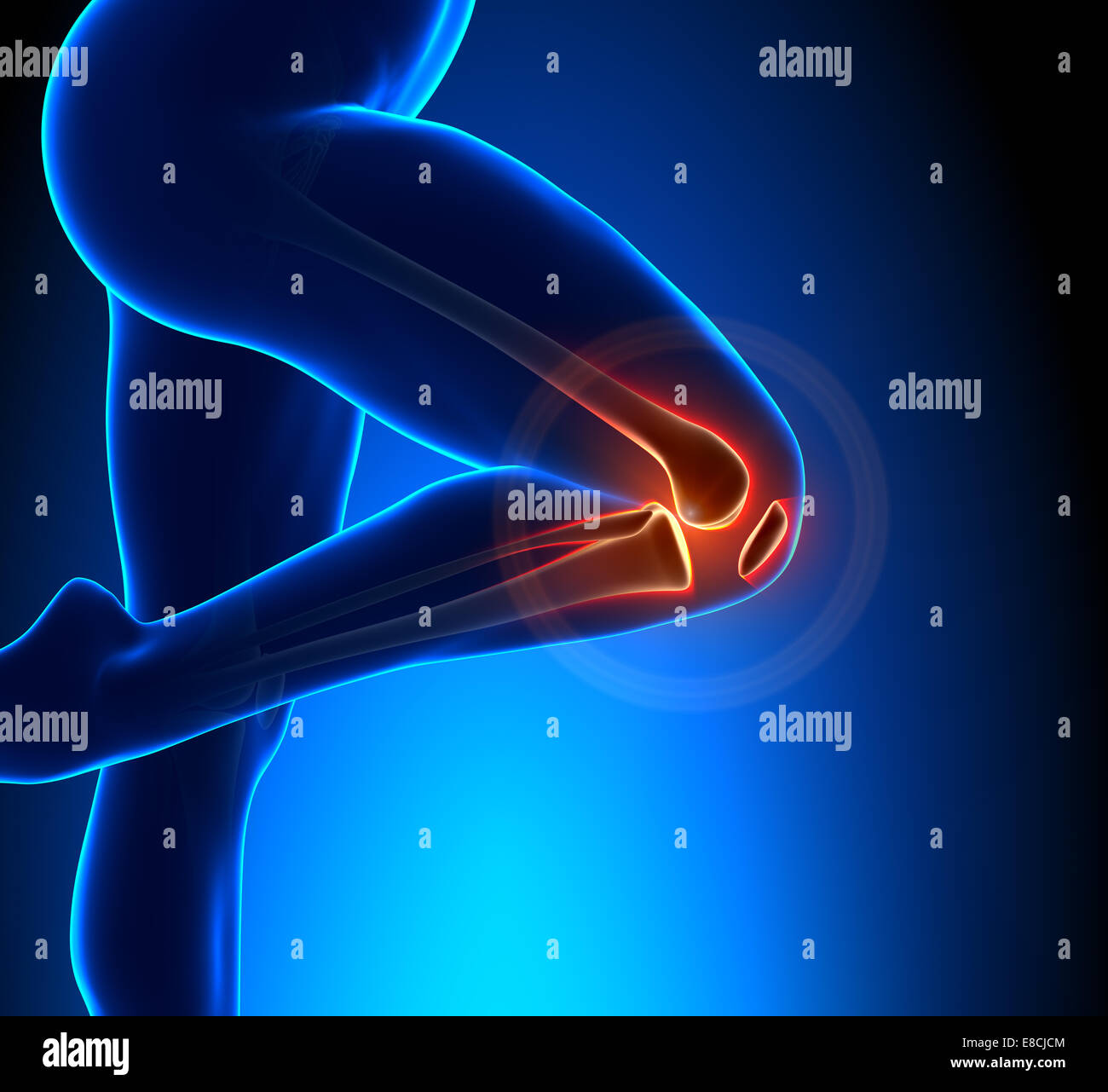 Human joint pain anatomy hires stock photography and images Alamy