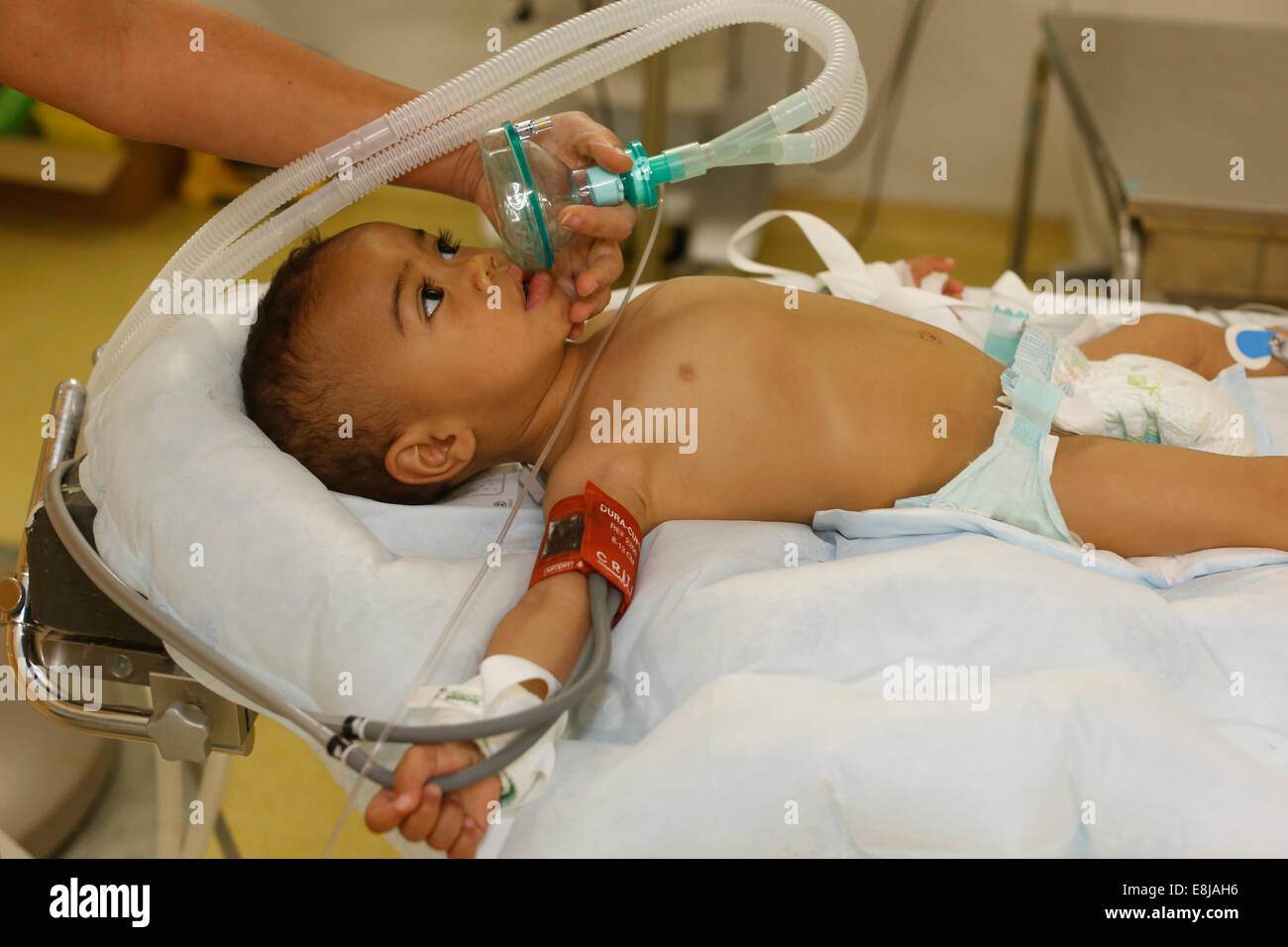 Child from Madagascar about to undergo heart surgery provided by French NGO La Chaine de l'Espoir (Surgeons of Hope) Stock Photo