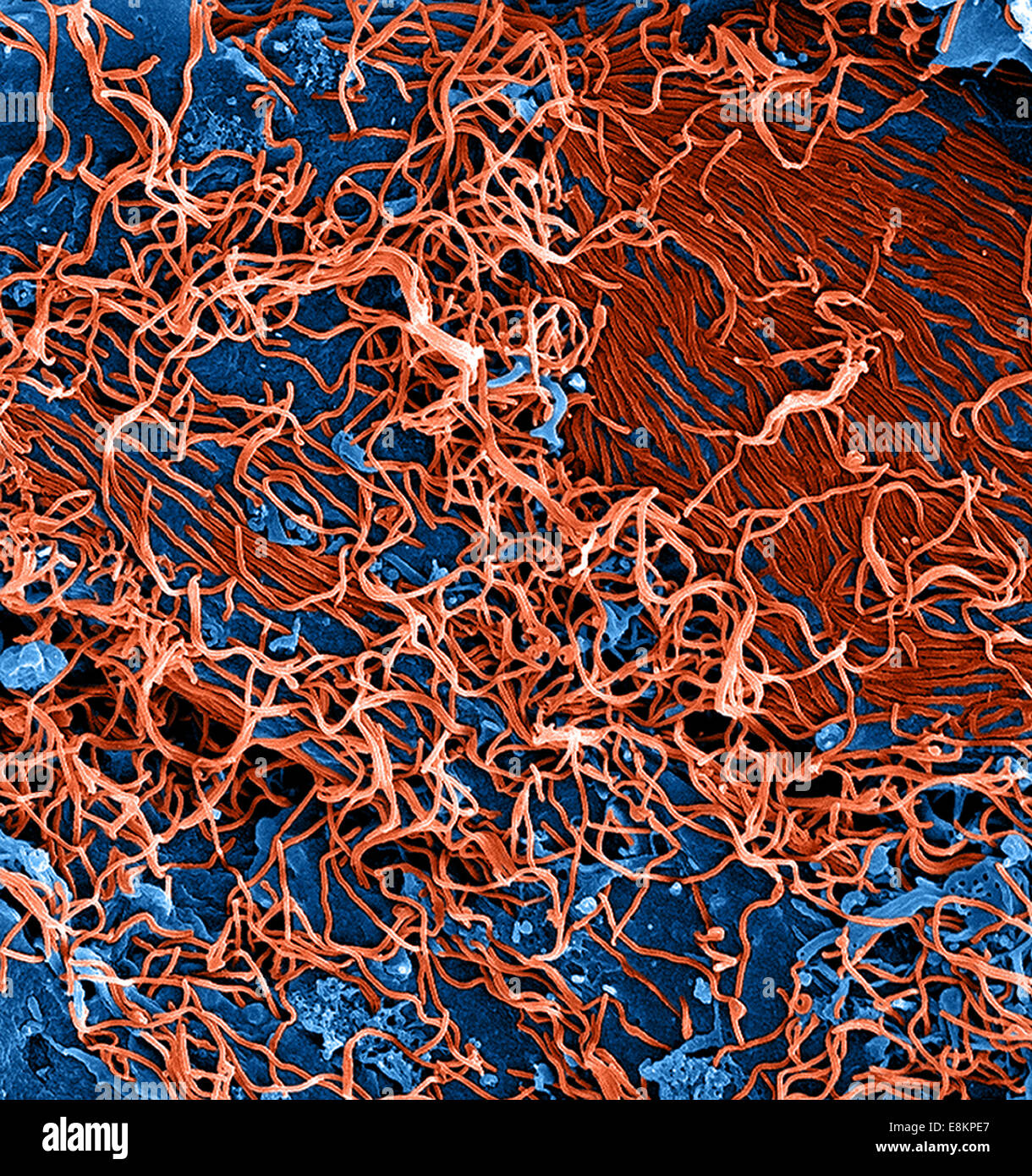 Colorized scanning electron micrograph of filamentous Ebola virus particles (red) attached and budding from chronically Stock Photo