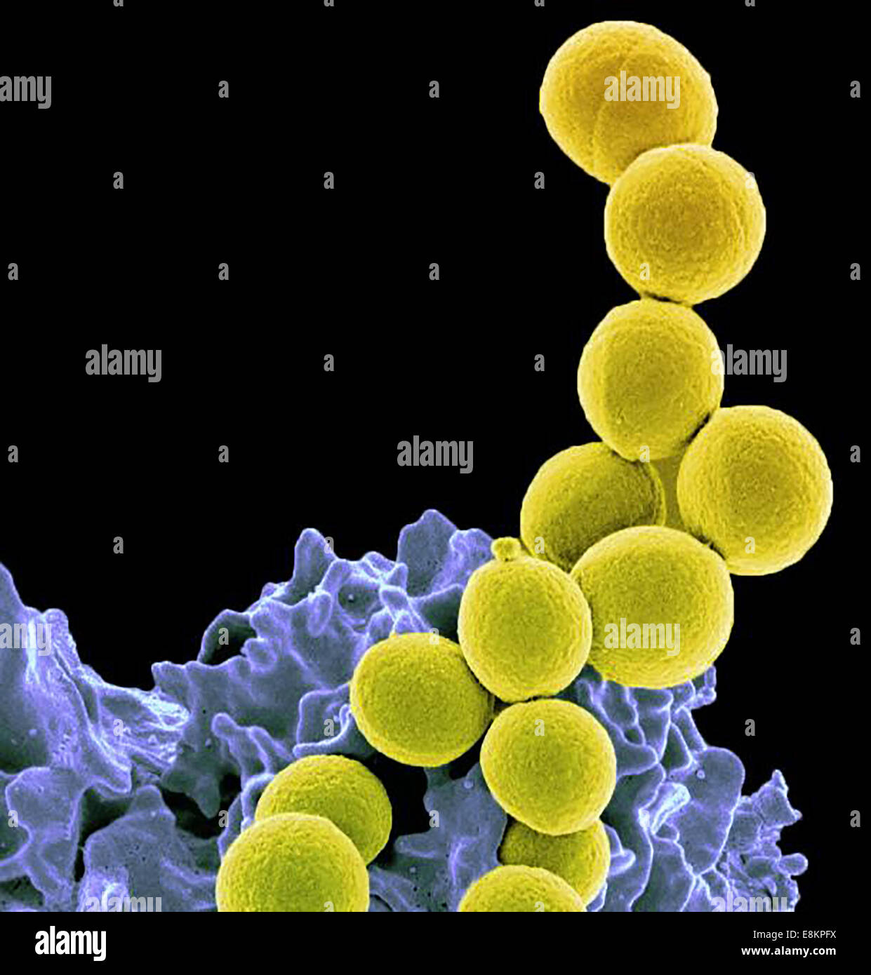 MRSA (yellow) being ingested by neutrophil (purplish blue). Stock Photo