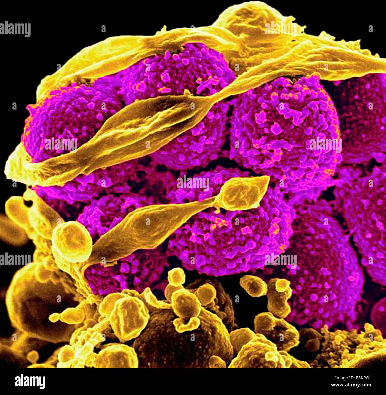 Scanning electron micrograph of methicillin-resistant Staphylococcus aureus bacteria (yellow, round items) killing and escaping Stock Photo
