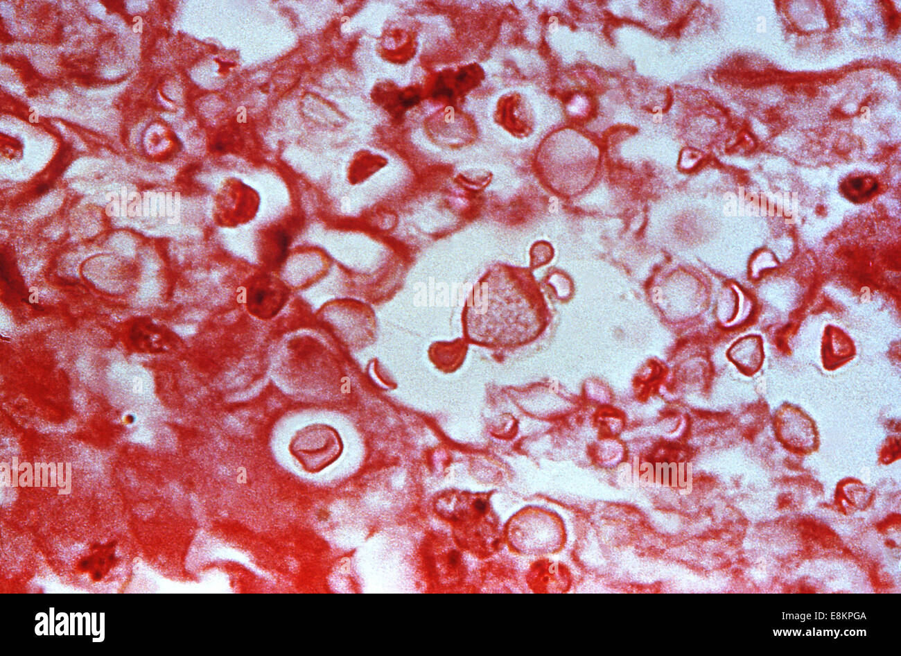 This photomicrograph depicted numbers of Cryptococcus neoformans fungi, etiologic agents responsible for disease cryptococcosis Stock Photo