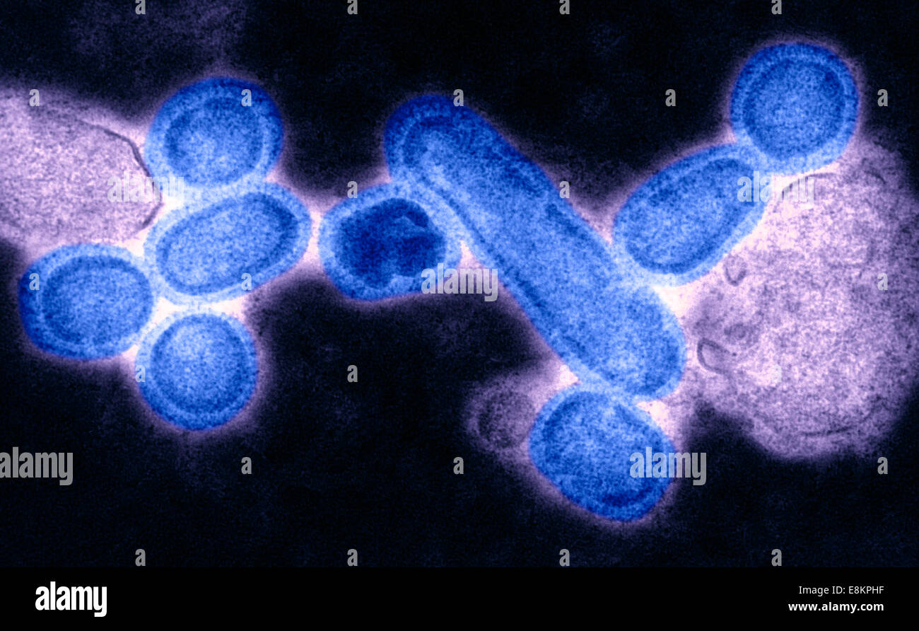 This colorized negative stained transmission electron micrograph (TEM) showed recreated 1918 influenza virions that were Stock Photo