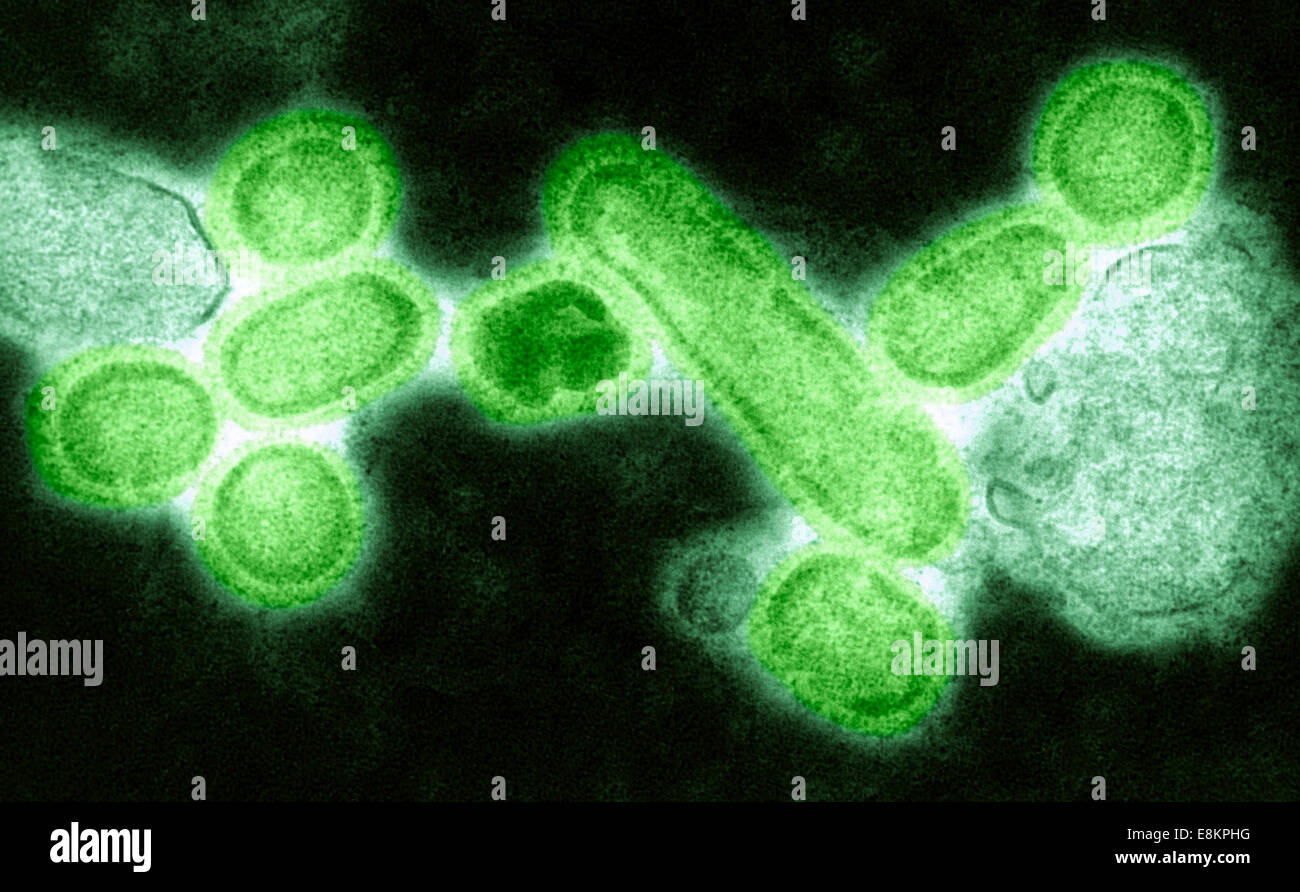 This colorized negative stained transmission electron micrograph (TEM) showed recreated 1918 influenza virions that were Stock Photo