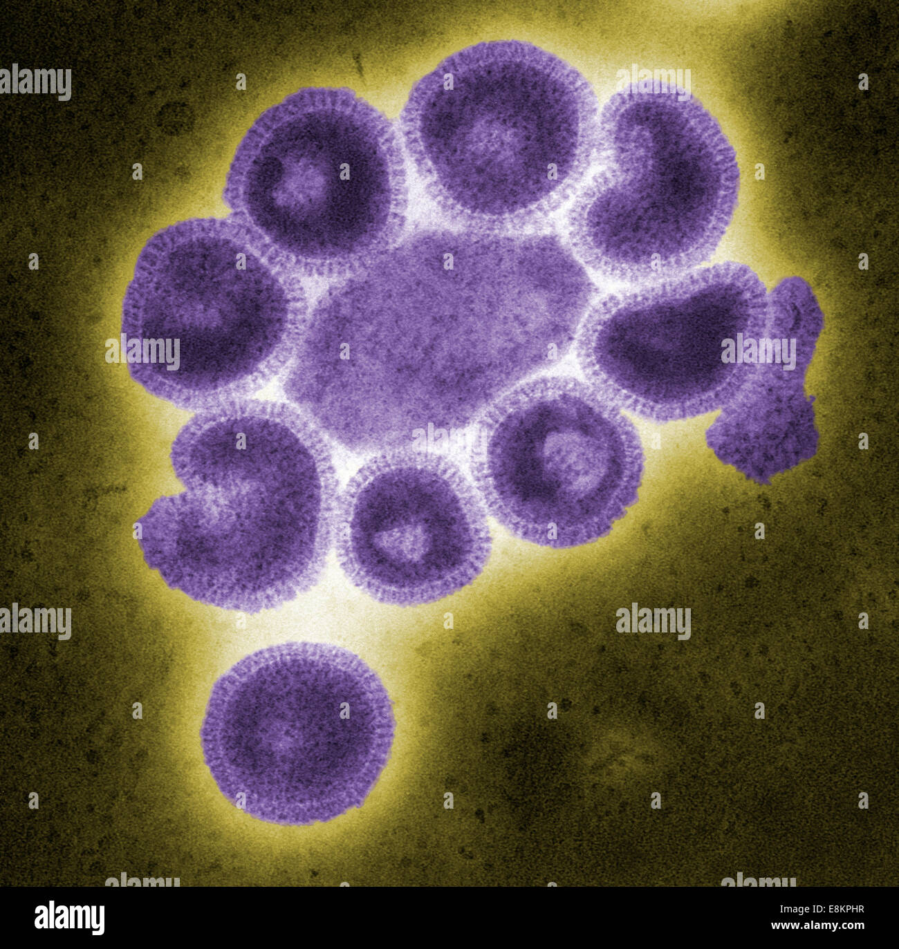 This colorized negative-stained transmission electron micrograph (TEM) depicts ultrastructural details of number of influenza Stock Photo