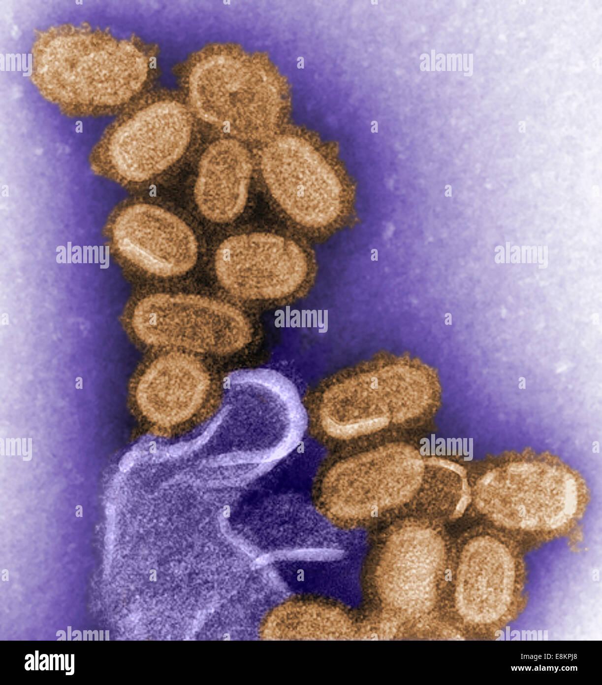 This colorized negative stained transmission electron micrograph (TEM) shows recreated 1918 influenza virions that were Stock Photo