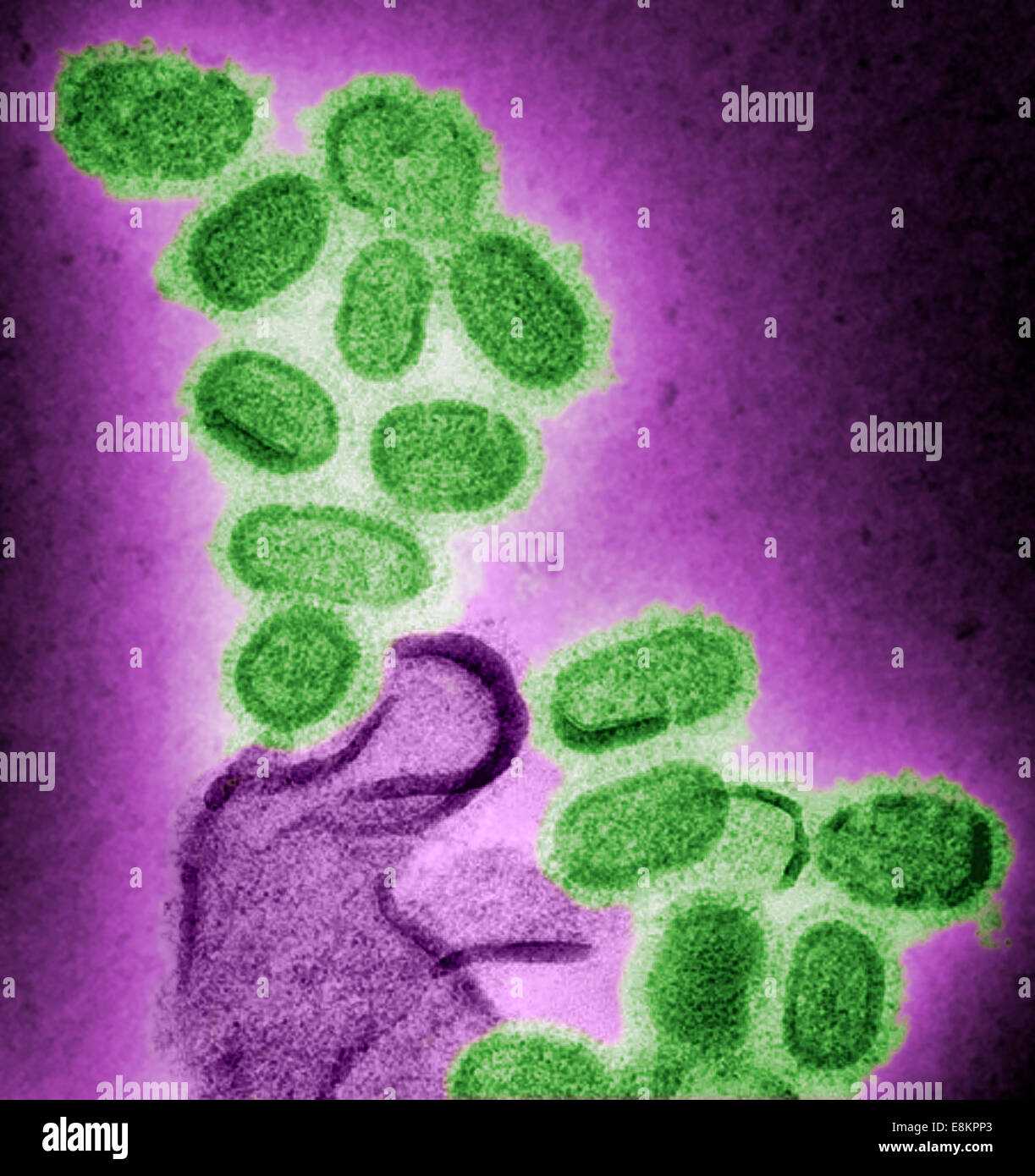 This colorized negative stained transmission electron micrograph (TEM) shows recreated 1918 influenza virions that were Stock Photo
