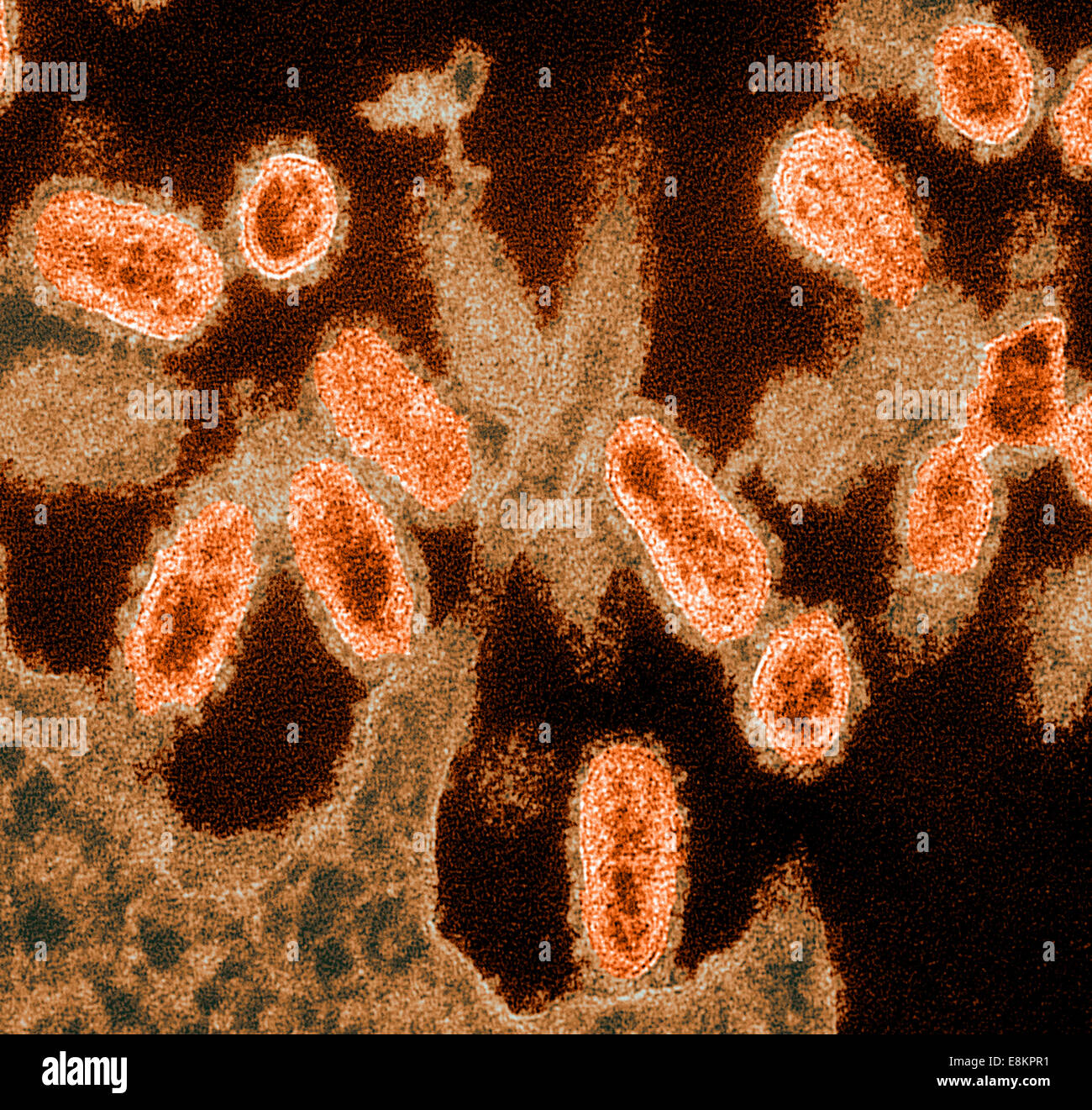 This colorized transmission electron micrograph (TEM) of an ultra-thin specimen revealed some of ultrastructural morphologic Stock Photo