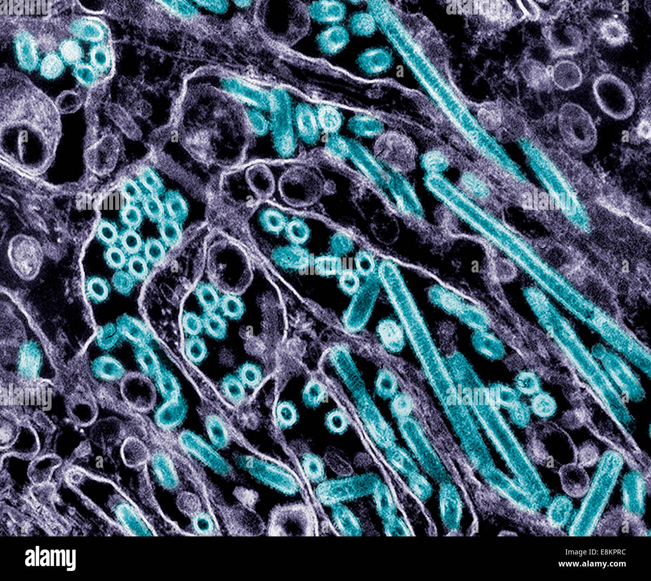 Transmission Electron Microscope Images Of Cells