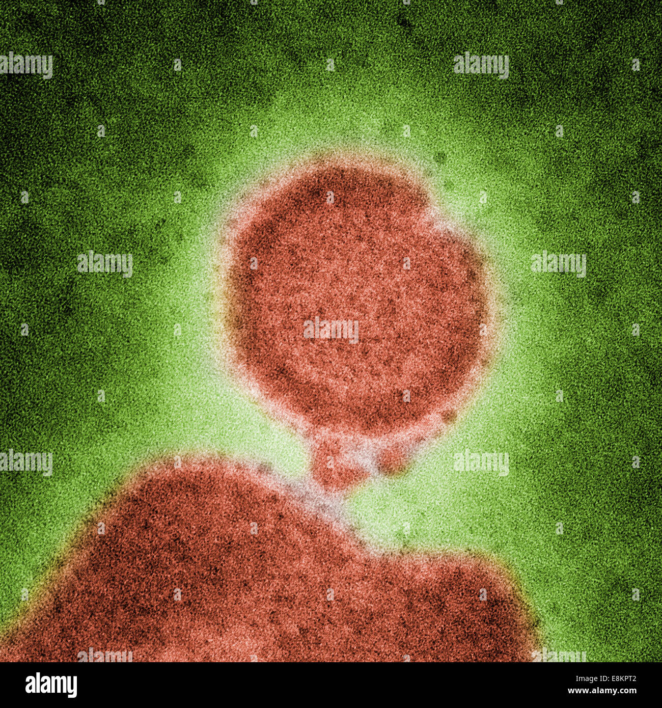 Under high magnification, this colorized negatively-stained transmission electron micrograph (TEM) captured some of Stock Photo