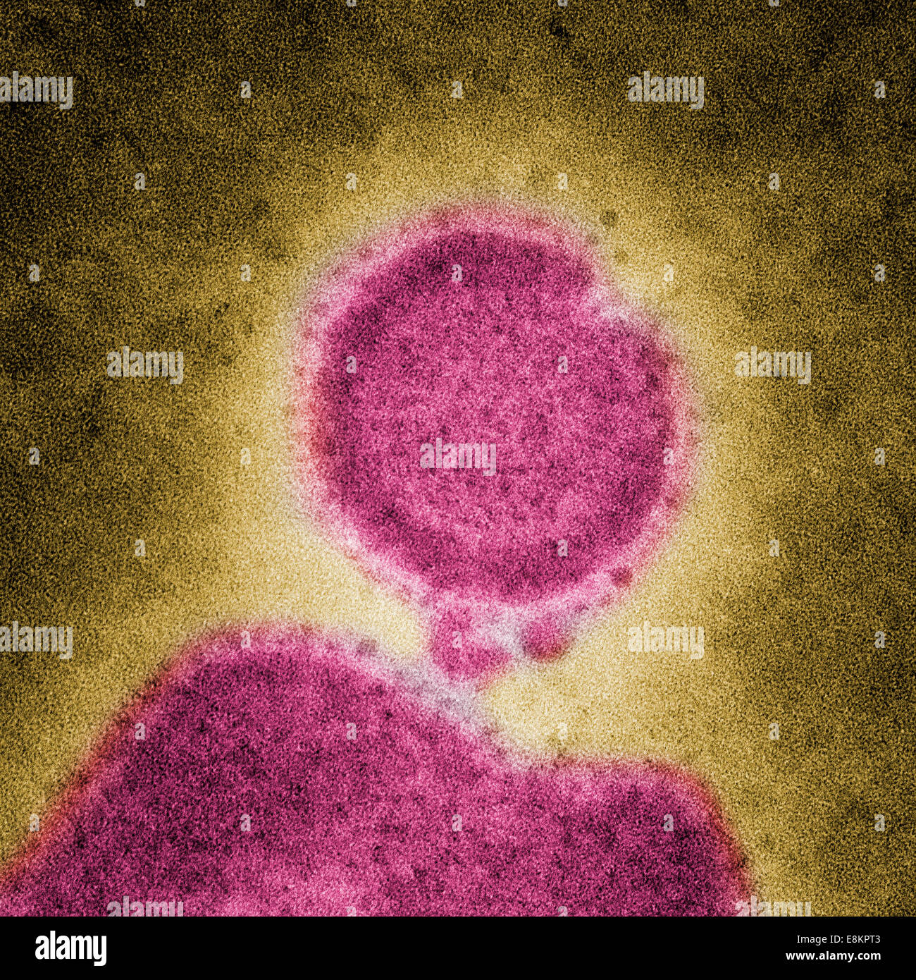 Under high magnification, this colorized negatively-stained transmission electron micrograph (TEM) captured some of Stock Photo