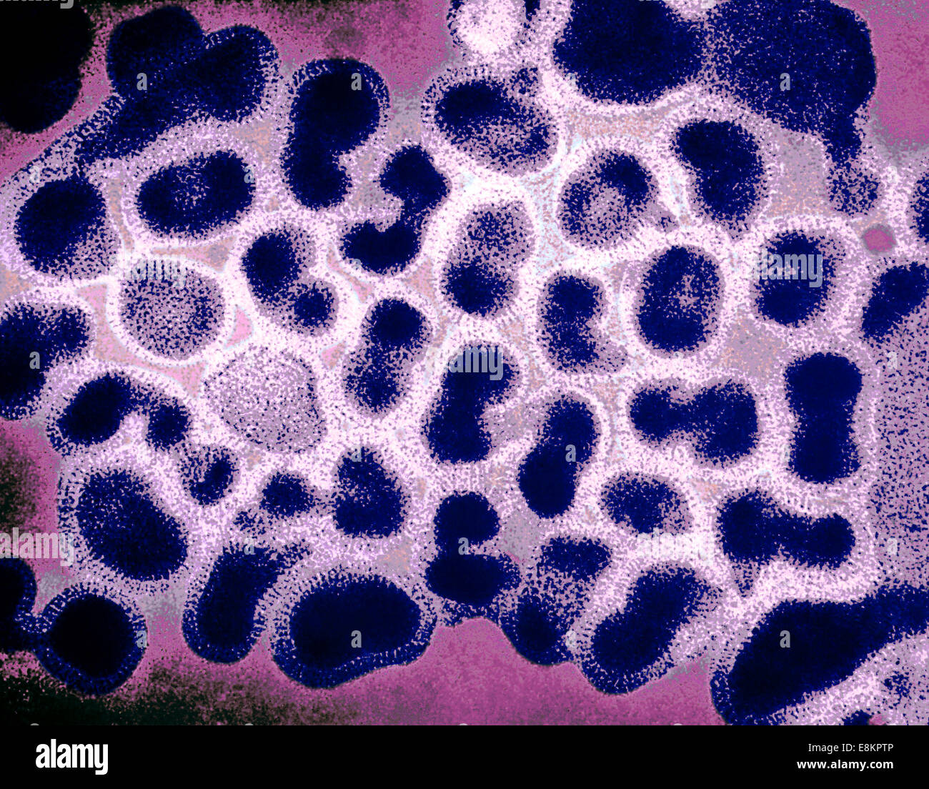 This colorized transmission electron micrograph (TEM) depicts numbers of influenza virions while in their late passage growth Stock Photo