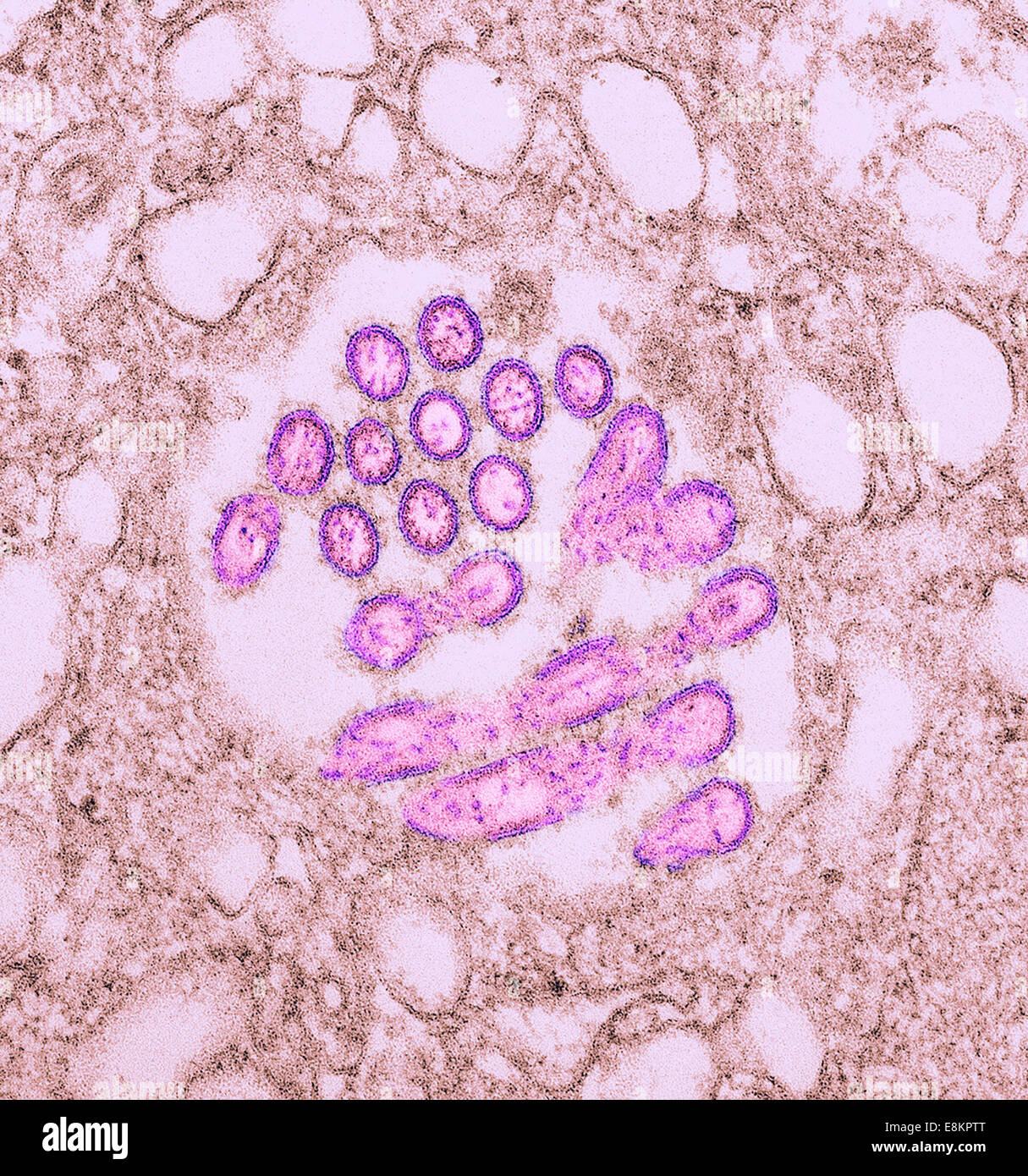 This colorized transmission electron micrograph (TEM) revealed presence of number of Novel H1N1 virus virions in this tissue Stock Photo