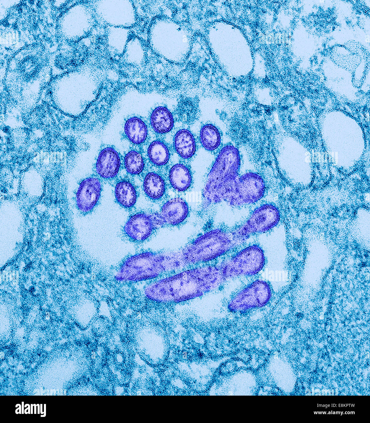 This colorized transmission electron micrograph (TEM) revealed presence of number of Novel H1N1 virus virions in this tissue Stock Photo