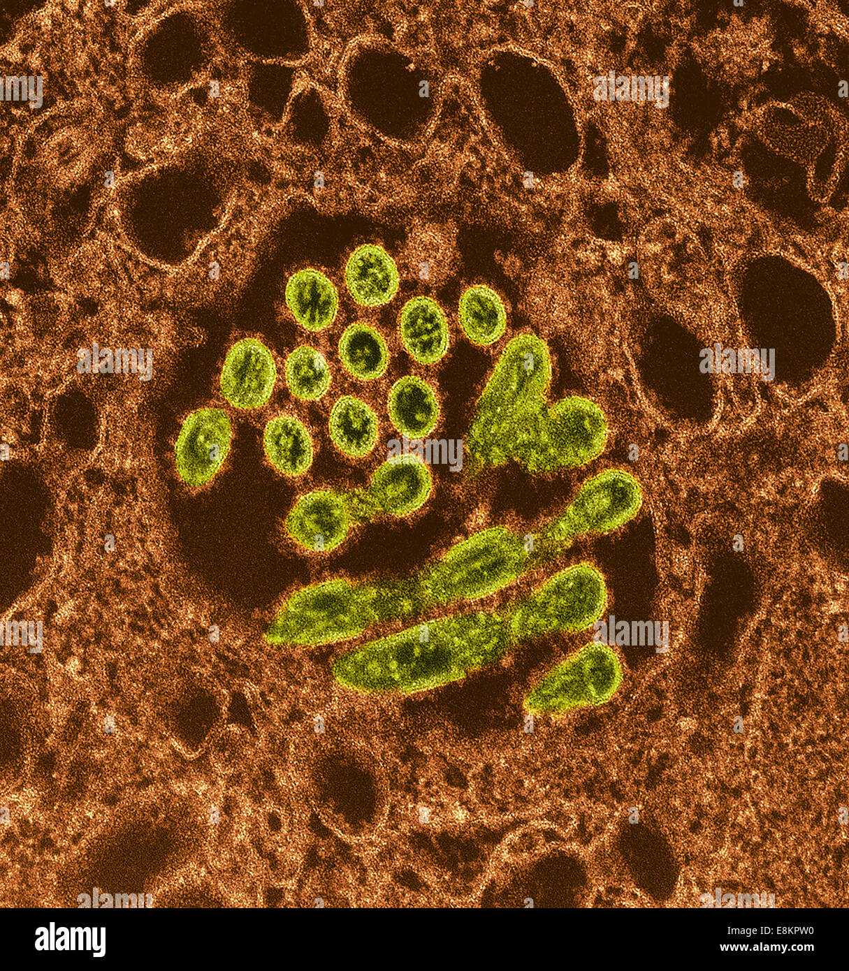This colorized transmission electron micrograph (TEM) revealed presence of number of Novel H1N1 virus virions in this tissue Stock Photo