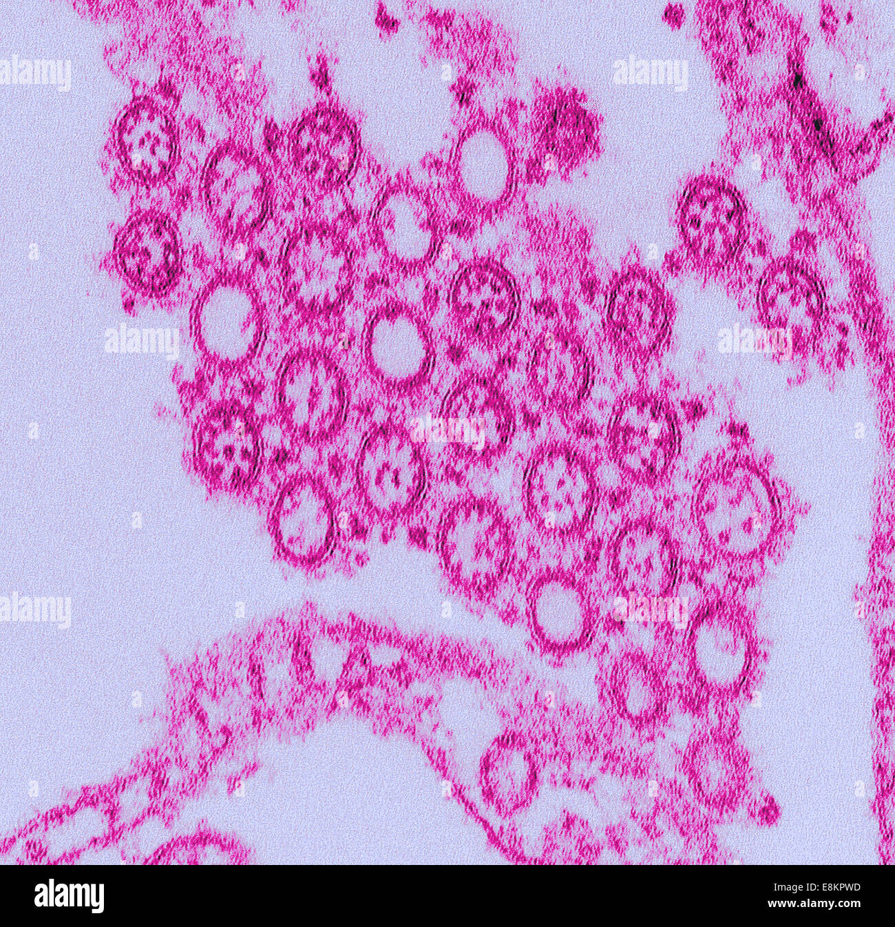 This highly-magnified, digitally-colorized transmission electron micrograph (TEM) depicted numbers of virions from Novel Flu Stock Photo