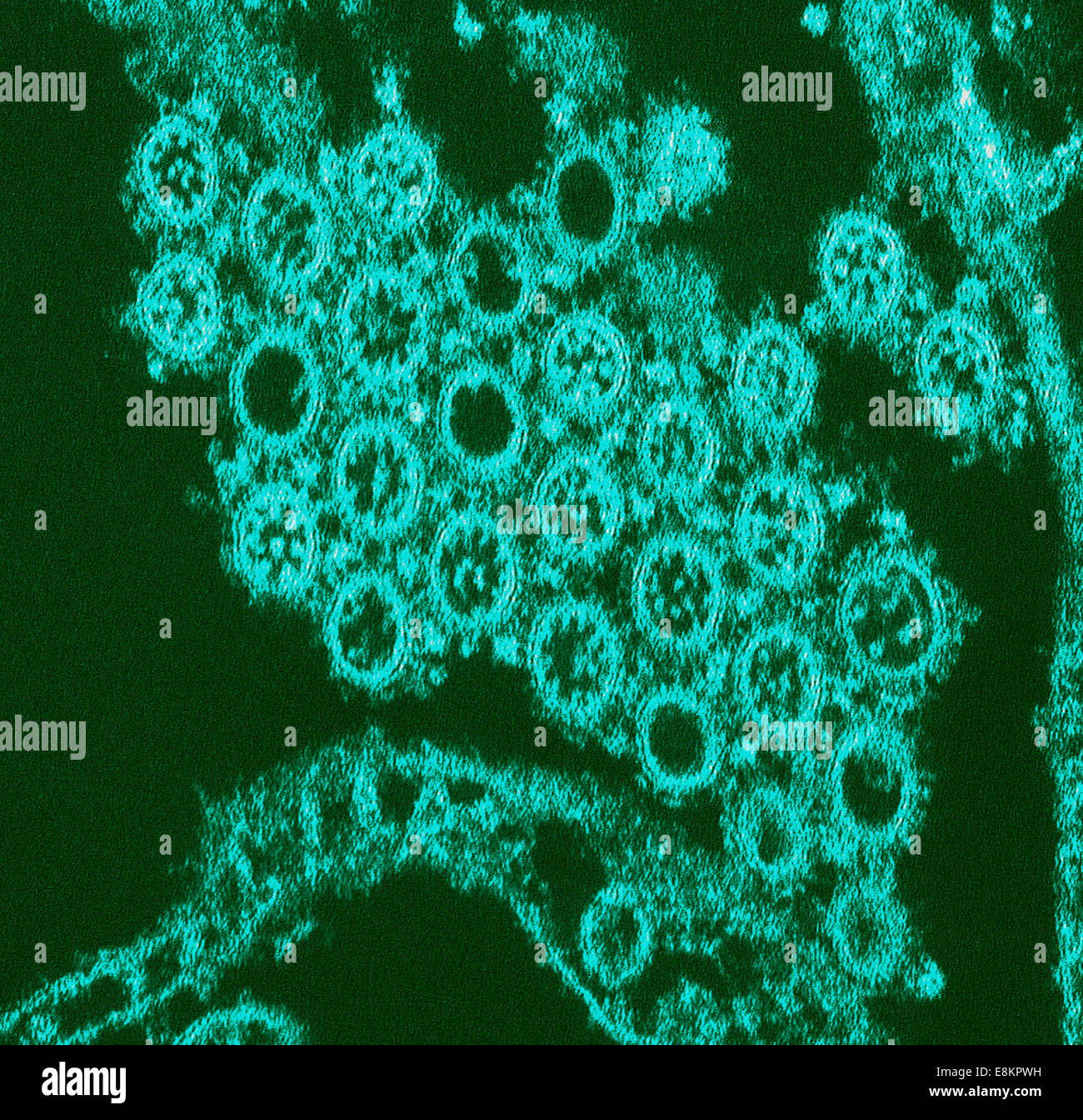 This highly-magnified, digitally-colorized transmission electron micrograph (TEM) depicted numbers of virions from Novel Flu Stock Photo
