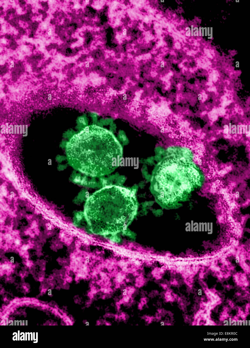 Colorized transmission electron micrograph showing particles of Middle East Respiratory Syndrome Coronavirus that emerged in Stock Photo