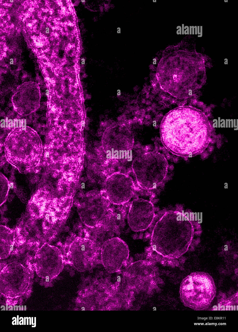 Colorized transmission electron micrograph showing particles of Middle East respiratory syndrome coronavirus that emerged in Stock Photo