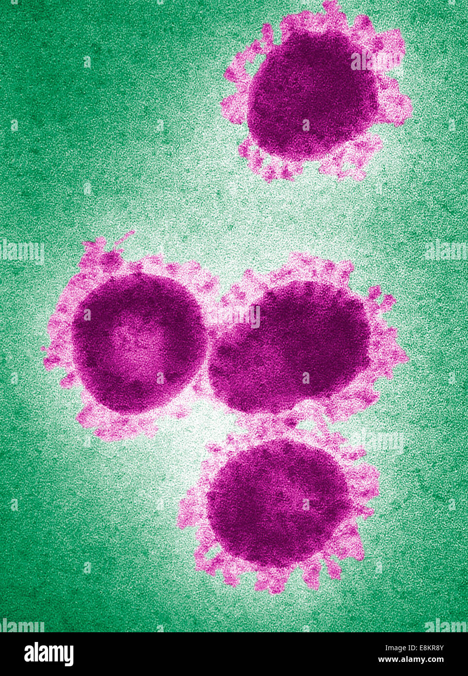 This digitally-colorized transmission electron micrograph (TEM) revealed presence of number of infectious bronchitis virus Stock Photo