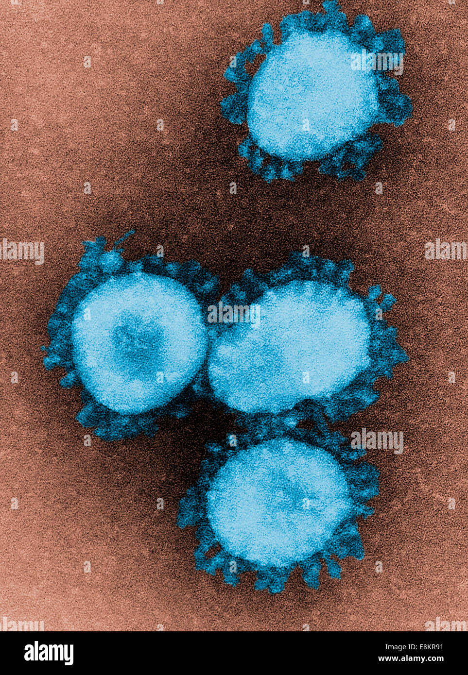 This digitally-colorized transmission electron micrograph (TEM) revealed presence of number of infectious bronchitis virus Stock Photo