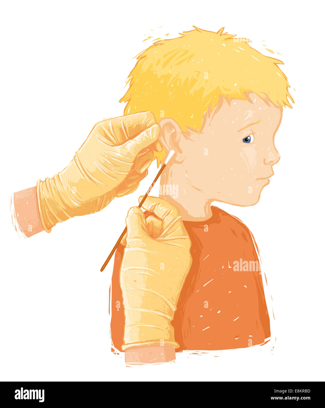 Taking a bacteria sample from a childs infected ear (otitis), in preparation for an antibiogram. Stock Photo