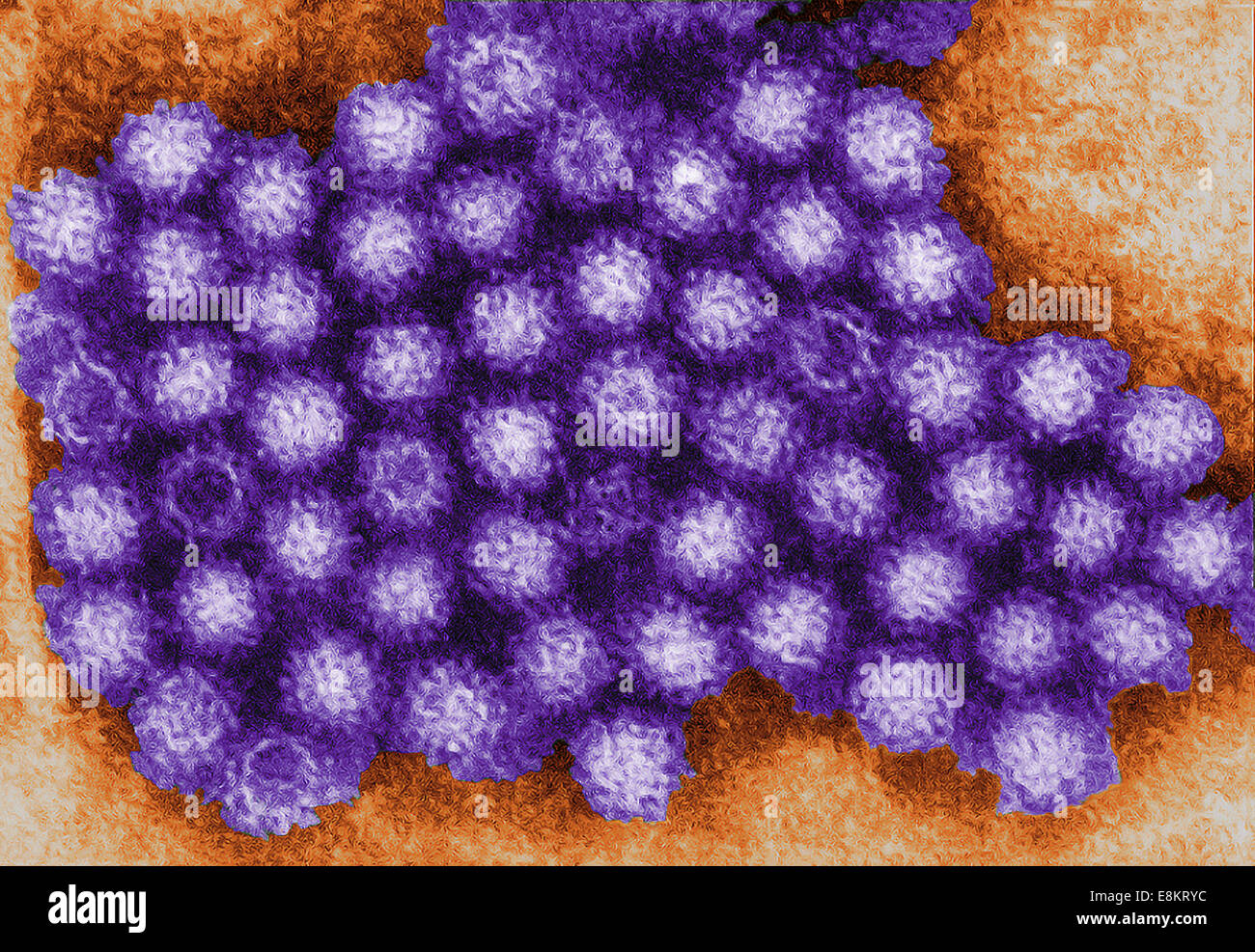 This transmission electron micrograph (TEM) revealed some of ultrastructural morphology displayed by norovirus virions, or Stock Photo