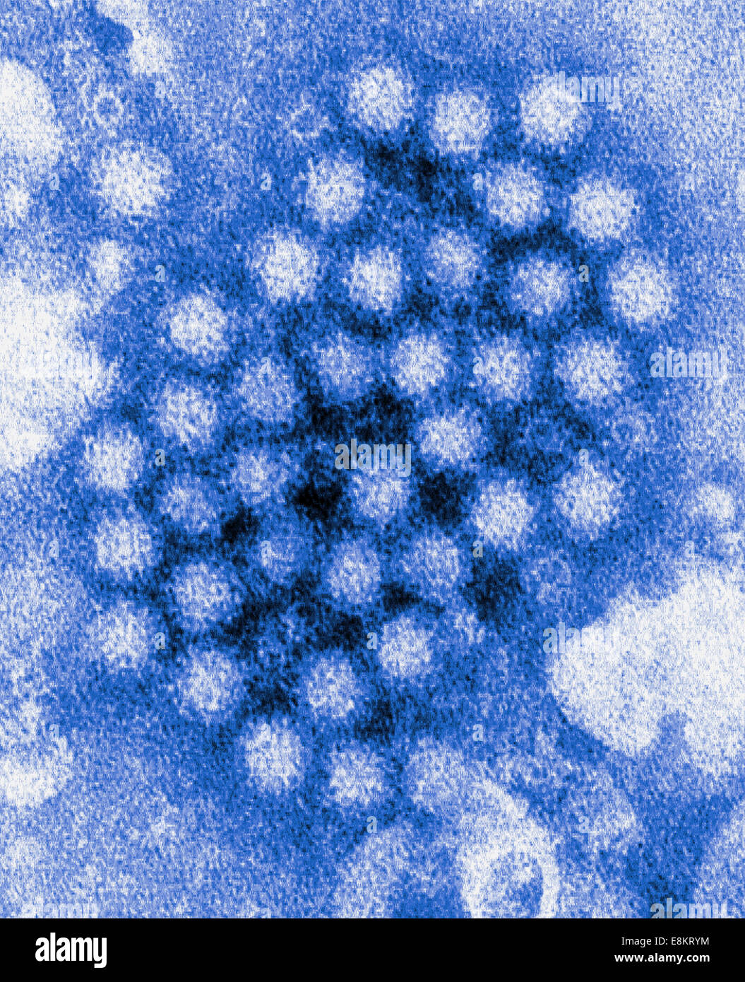 This colorized transmission electron micrograph (TEM) revealed some of ultrastructural morphology displayed by norovirus Stock Photo