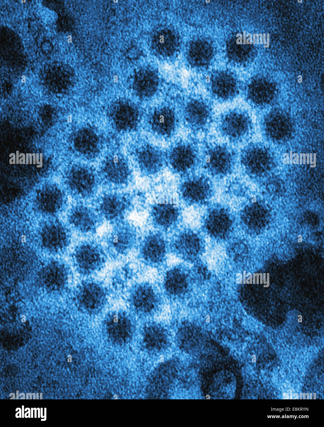 This colorized transmission electron micrograph (TEM) revealed some of ultrastructural morphology displayed by norovirus Stock Photo