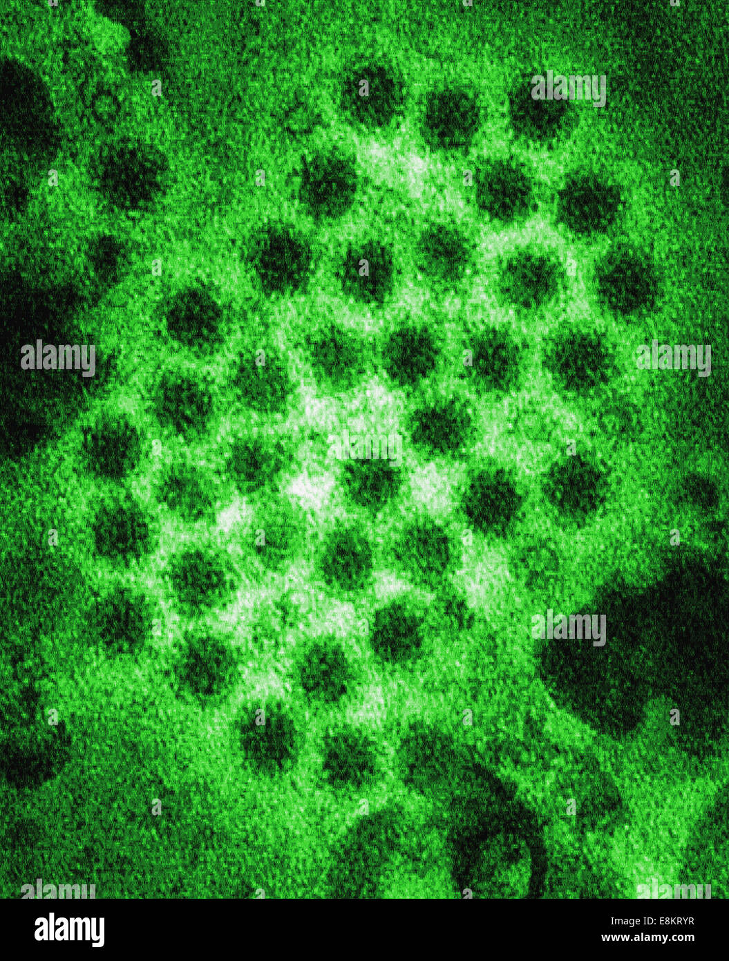 This colorized transmission electron micrograph (TEM) revealed some of ultrastructural morphology displayed by norovirus Stock Photo