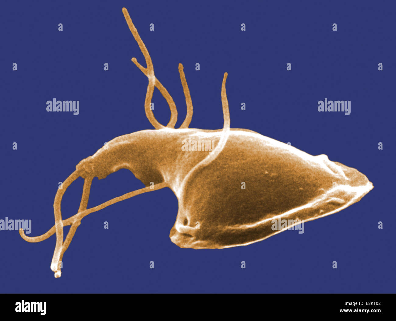 This digitally-colorized scanning electron micrograph (SEM) depicted dorsal (upper) surface of Giardia protozoan that had been Stock Photo