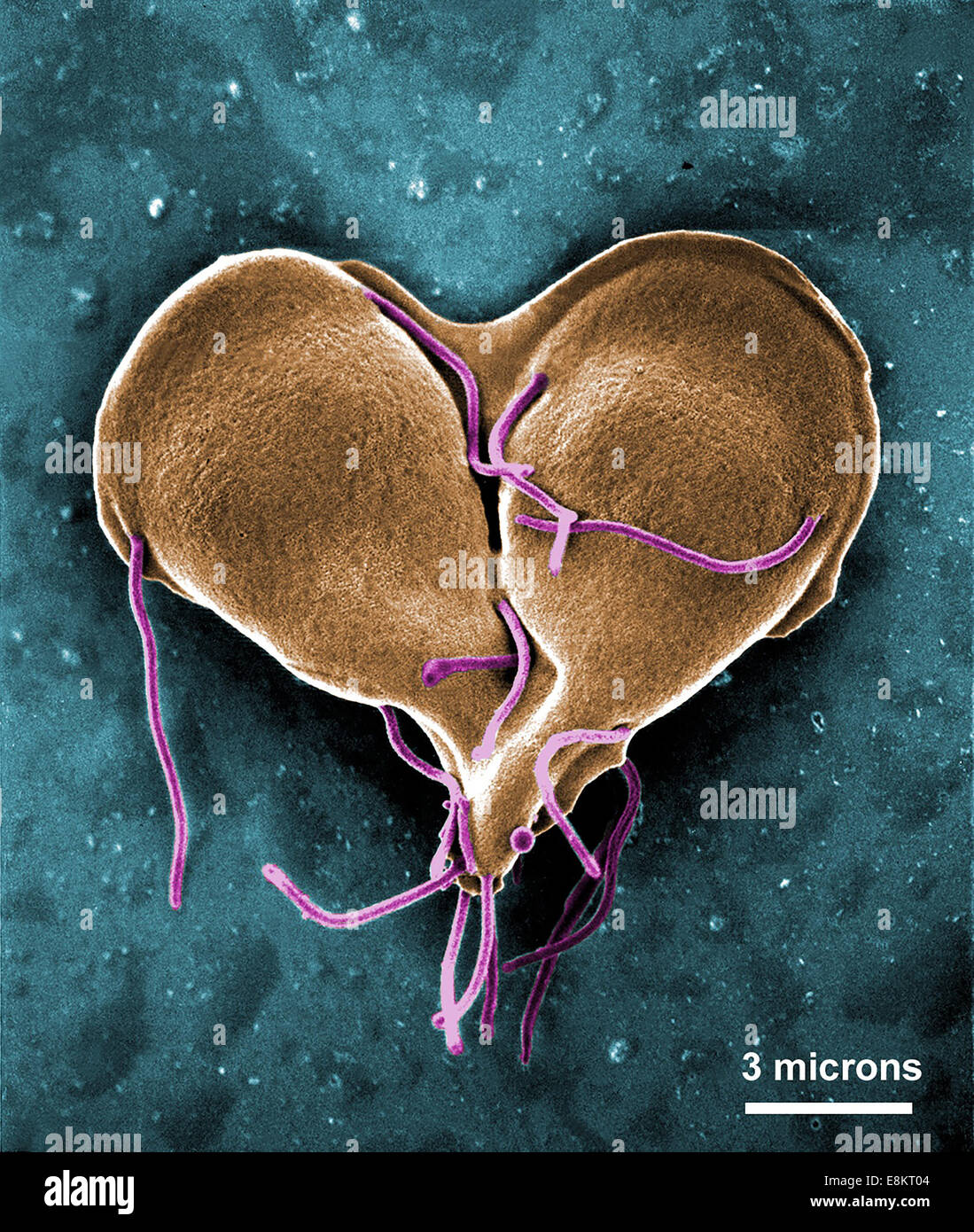 This digitally-colorized scanning electron micrograph (SEM) depicted Giardia lamblia protozoan that was about to become two, Stock Photo