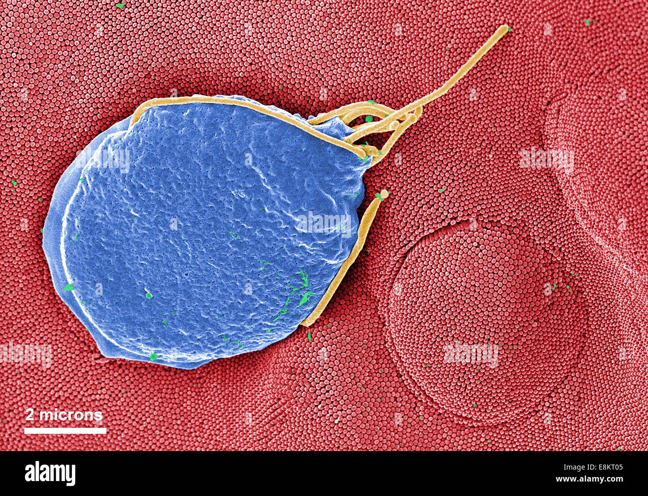 This digitally-colorized scanning electron micrograph (SEM) depicted Giardia muris protozoan adhering itself to microvillous Stock Photo