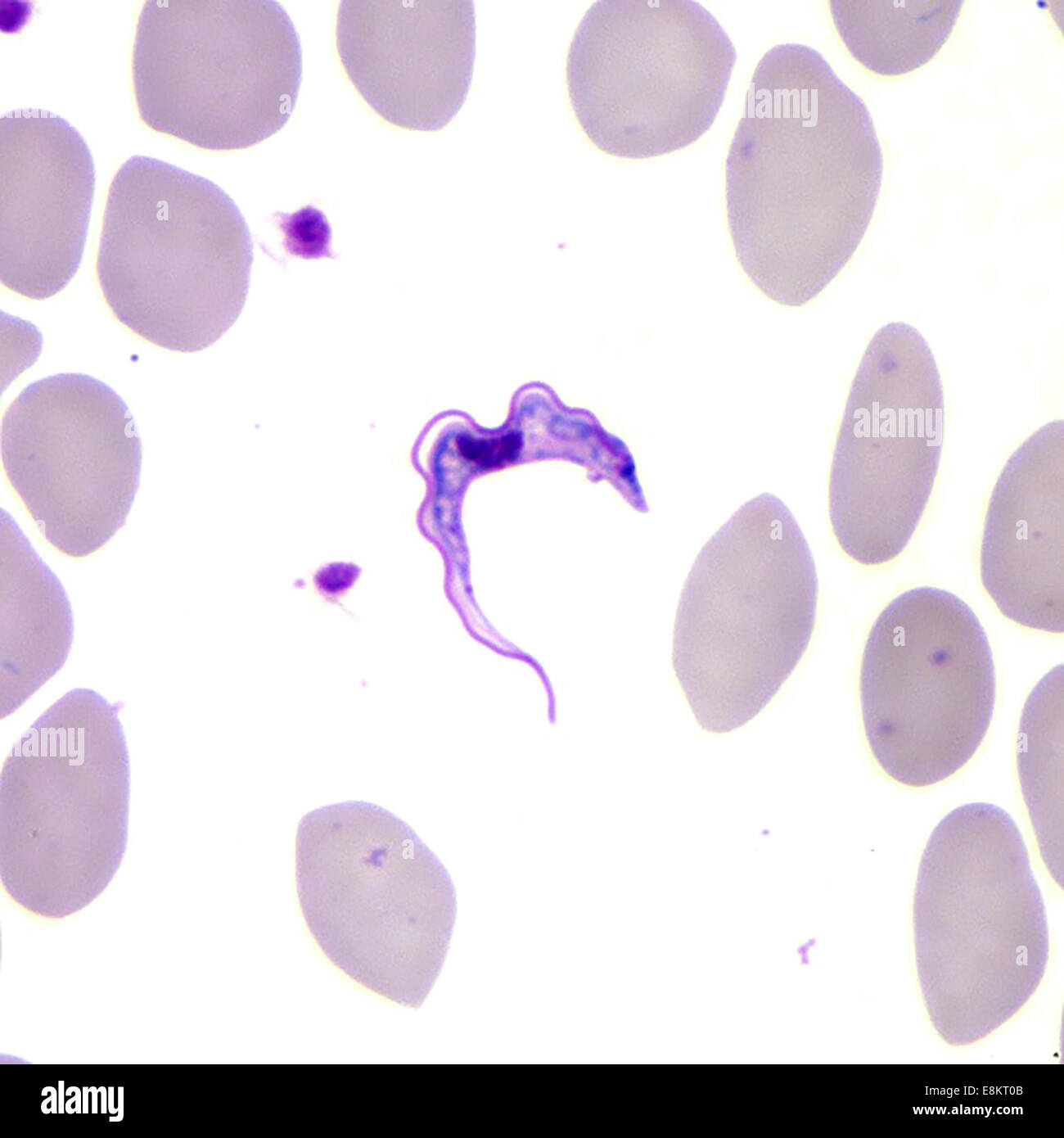 This Giemsa-stained light photomicrograph revealed presence of two Trypanosoma brucei parasites, which were found in blood Stock Photo