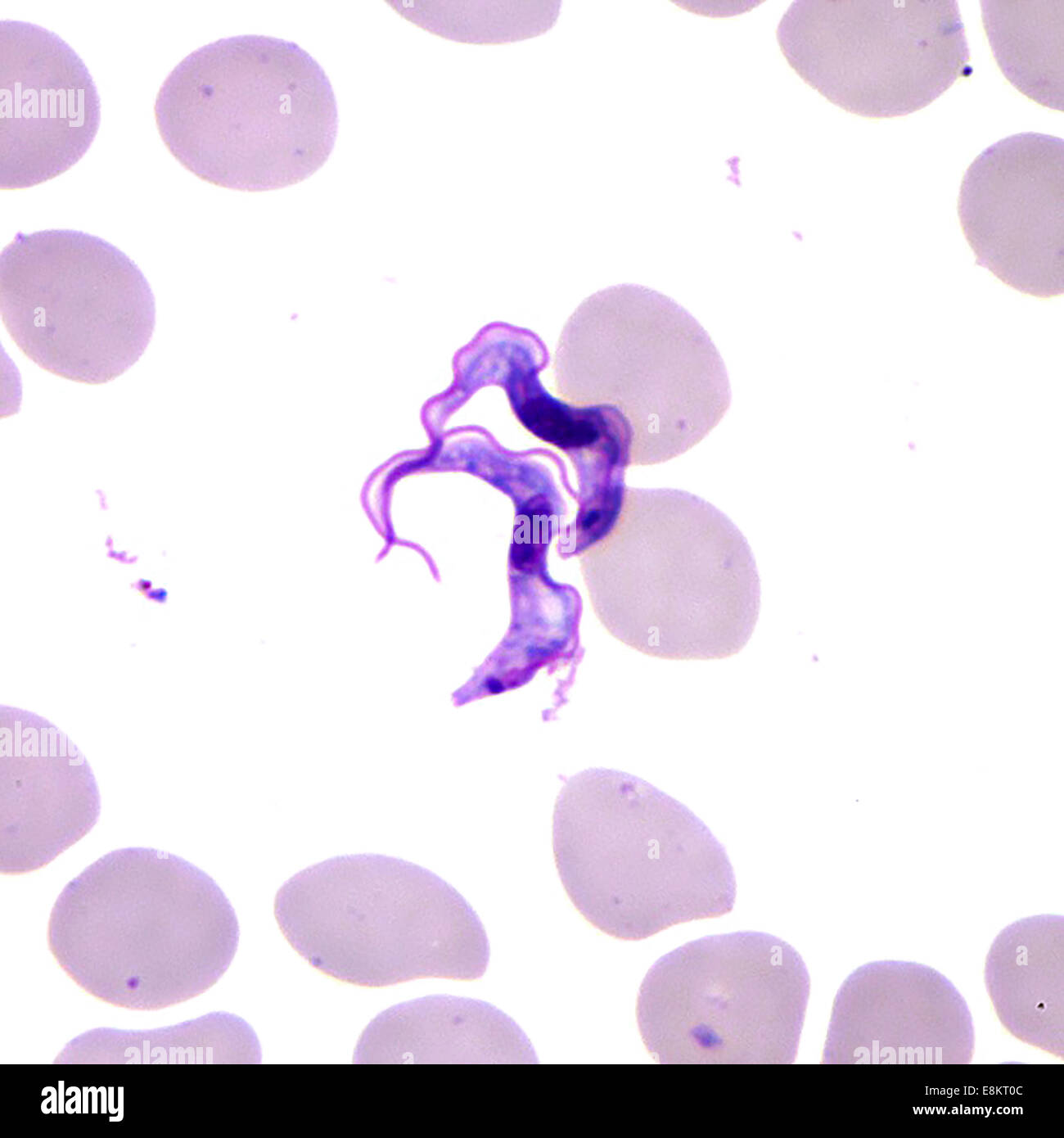 This Giemsa-stained light photomicrograph revealed presence of two Trypanosoma brucei parasites, which were found in blood Stock Photo