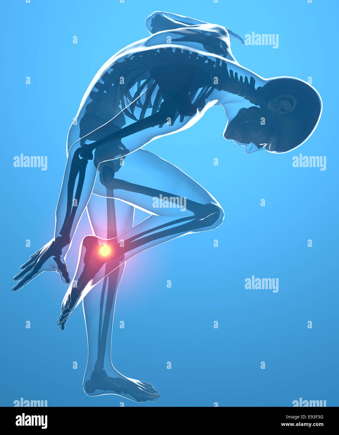 3D Painful ankle illustration on human Stock Photo