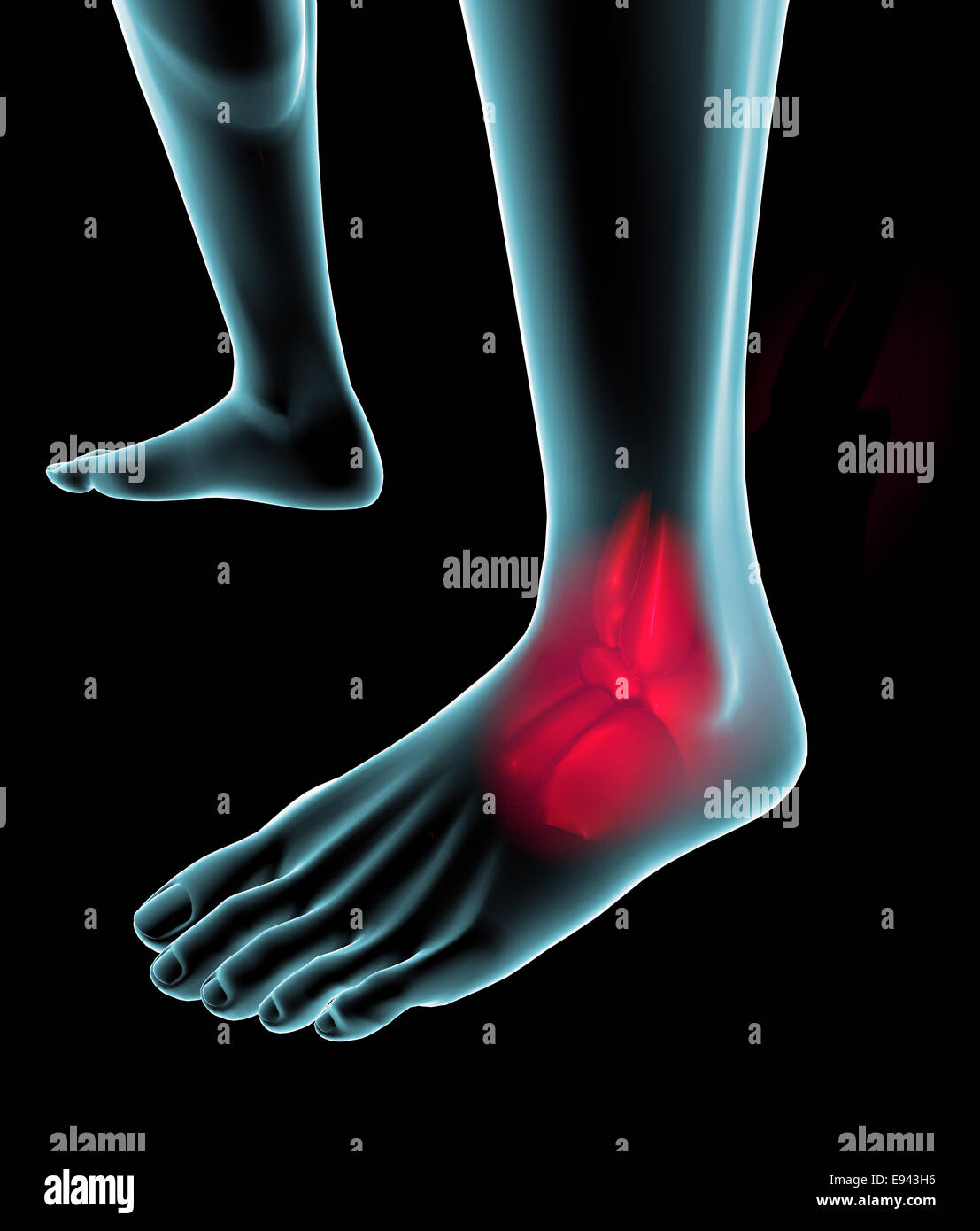 Foot seen on x-ray with pain in the ankle and the plant Stock Photo