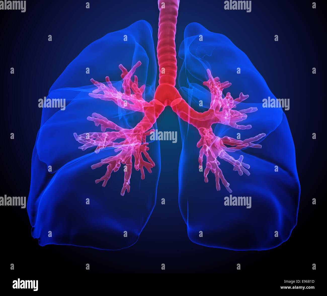 3D medical illustration - lungs with visible bronchi Stock Photo