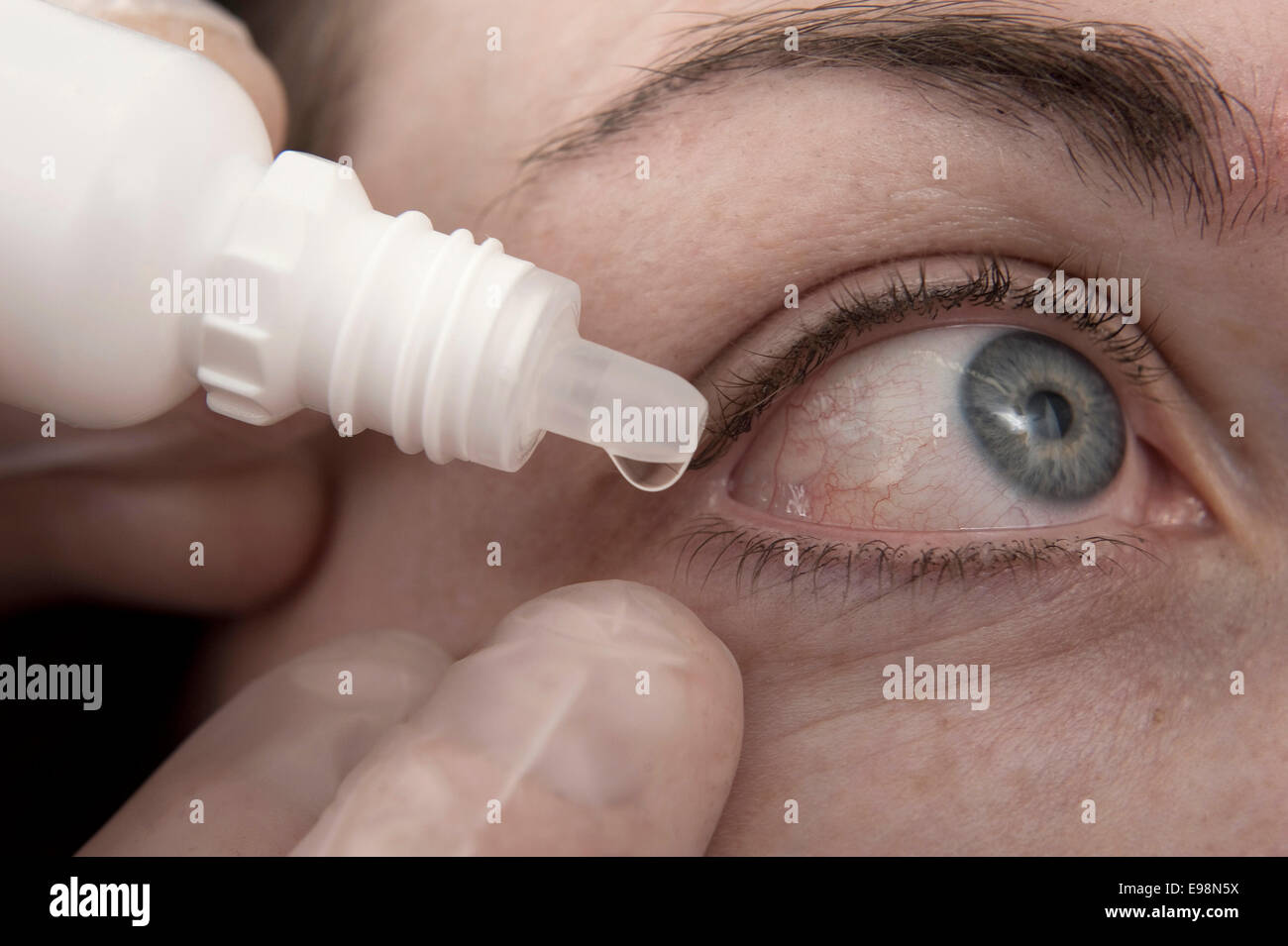 Optrex Intensive Eye Drops For Dry Eyes Contact Lenses