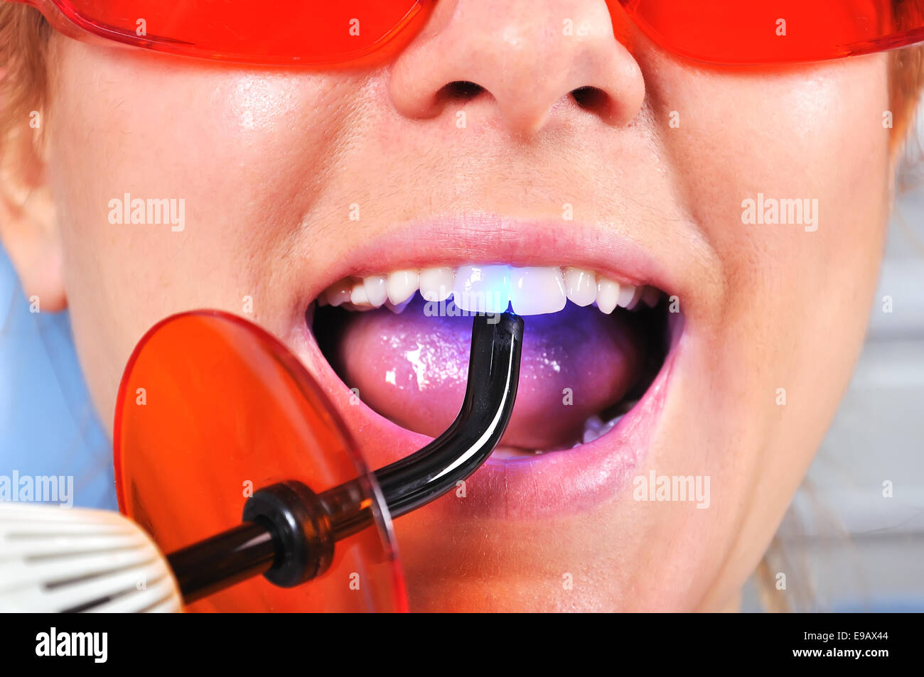 tooth filling ultraviolet lamp, close up Stock Photo