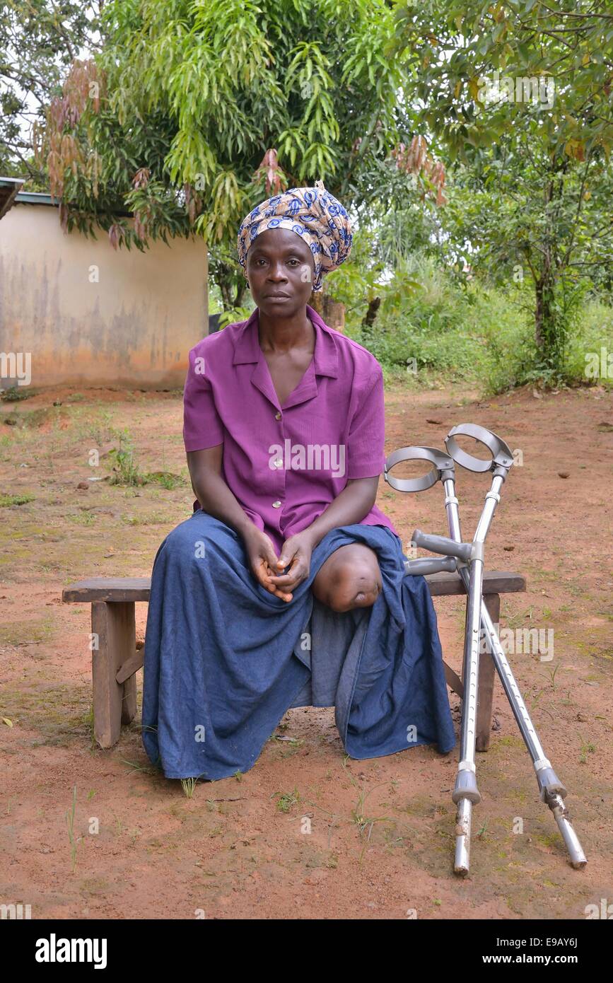 Young woman with prosthetic leg using smart phone by female friend