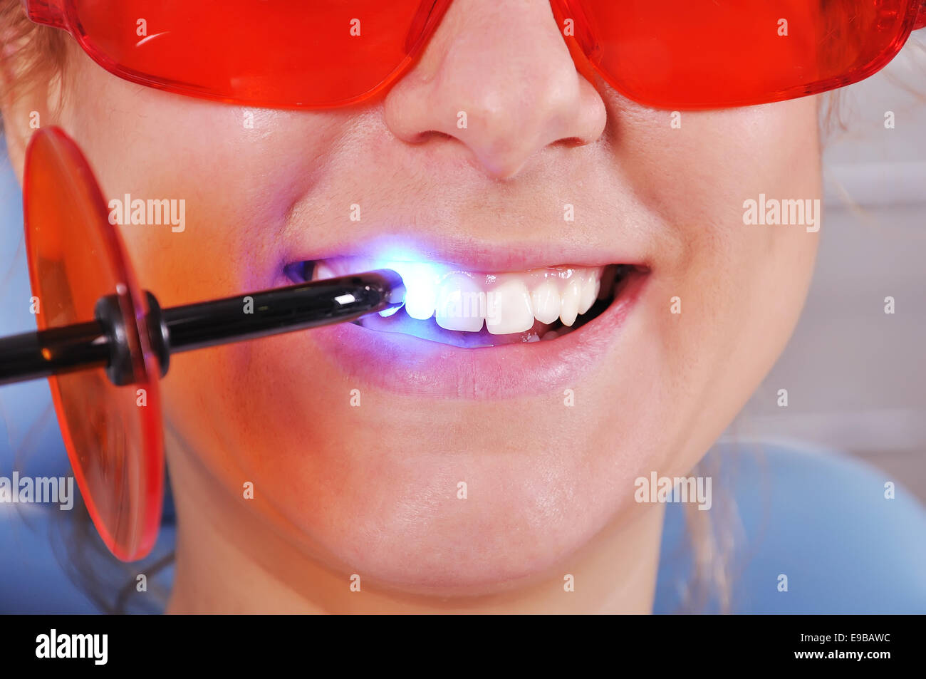 filling tooth ultraviolet lamp, close up Stock Photo