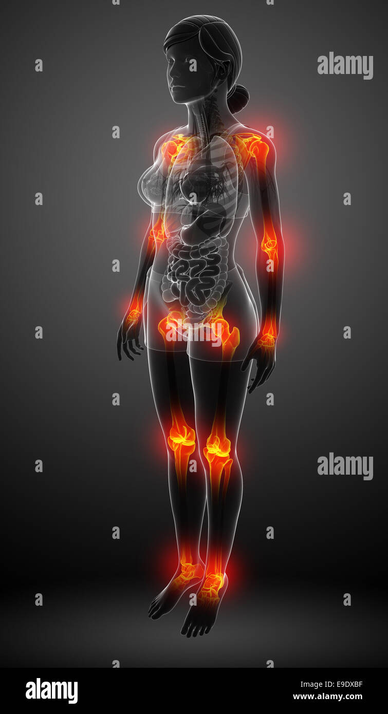 Illustration of female body all joint pain Stock Photo - Alamy