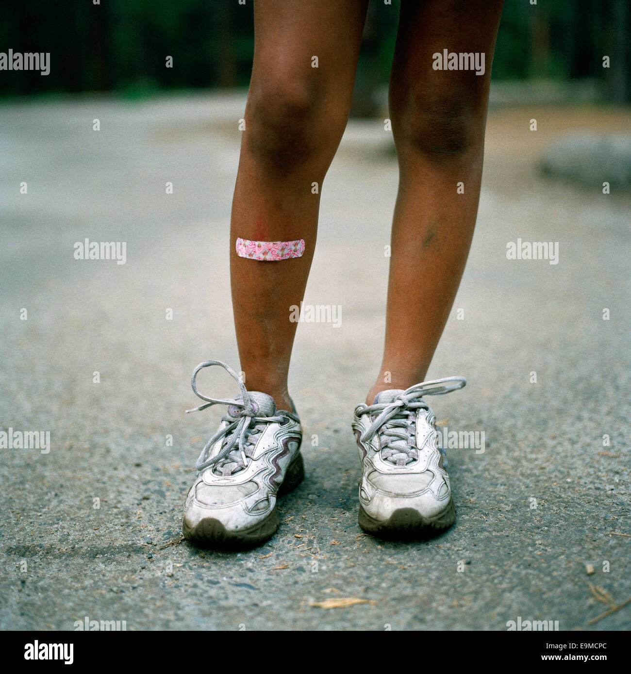 An Adhesive Bandage on a child's leg Stock Photo Alamy