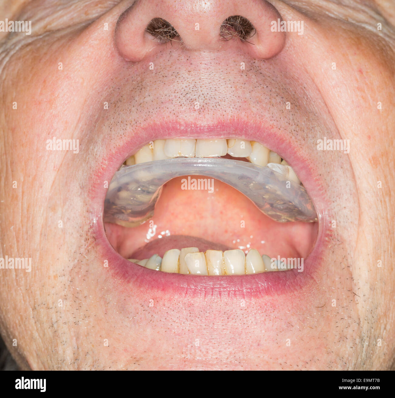 Close up of teeth guard in senior mouth Stock Photo