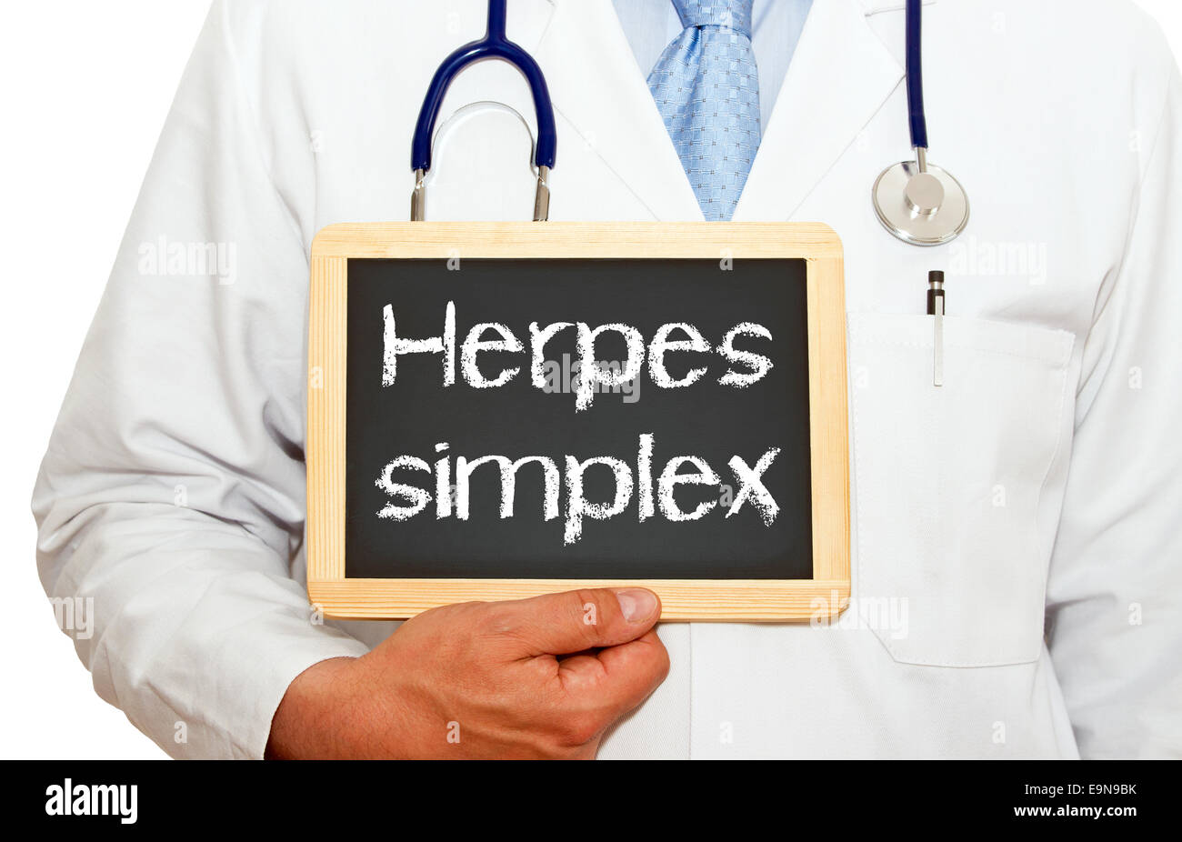 Herpes simplex Stock Photo