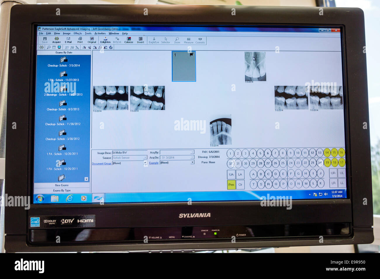 Miami Beach Florida,dentist office,computer screen monitor,teeth,tooth,xray,x-ray,FL140704001 Stock Photo