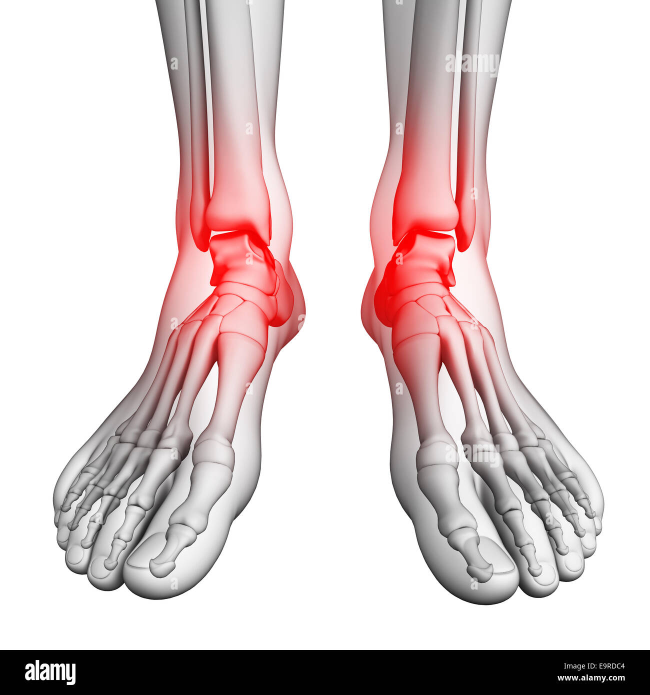 Illustration of foot pain artwork Stock Photo