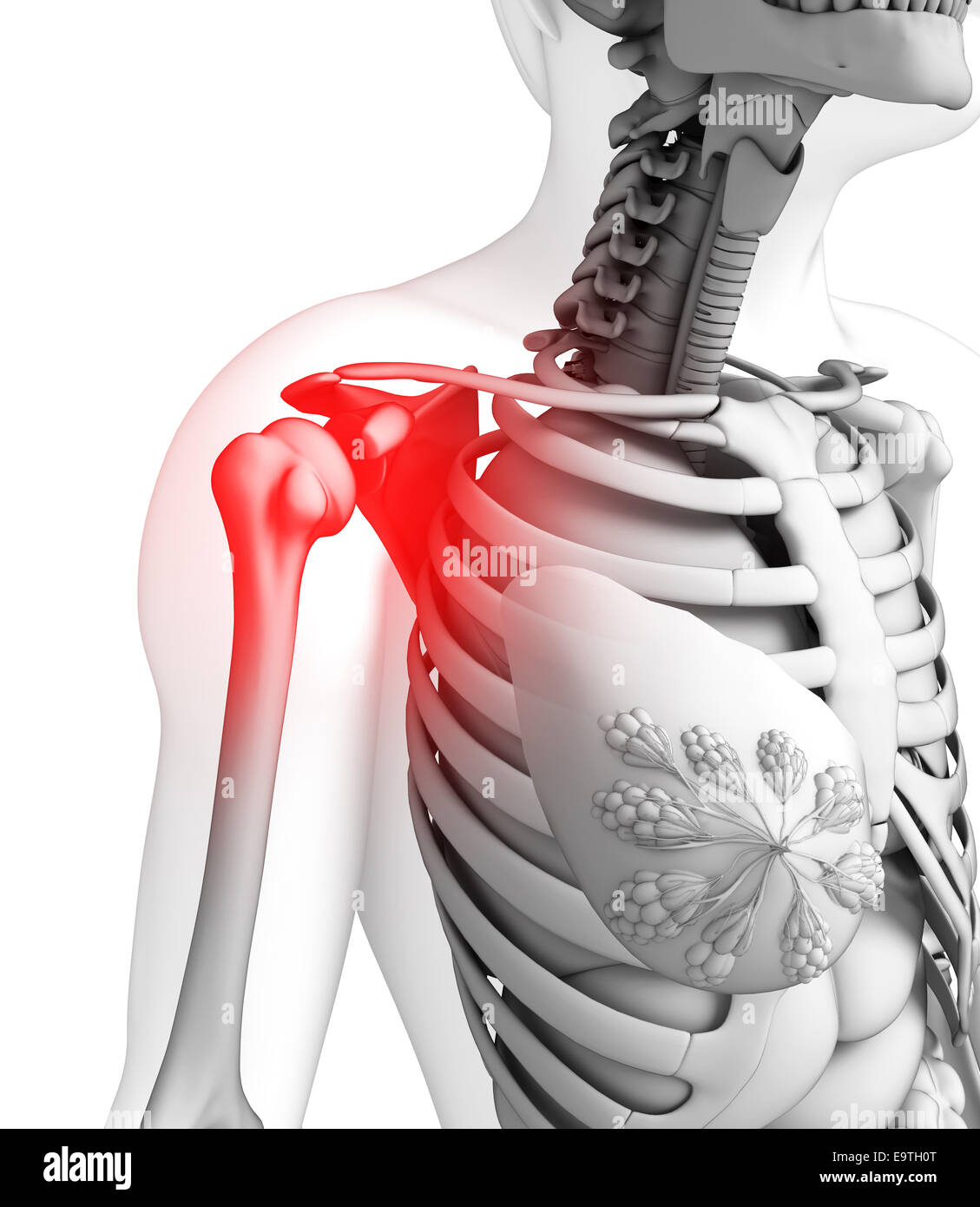 Illustration of shoulder pain artwork Stock Photo Alamy